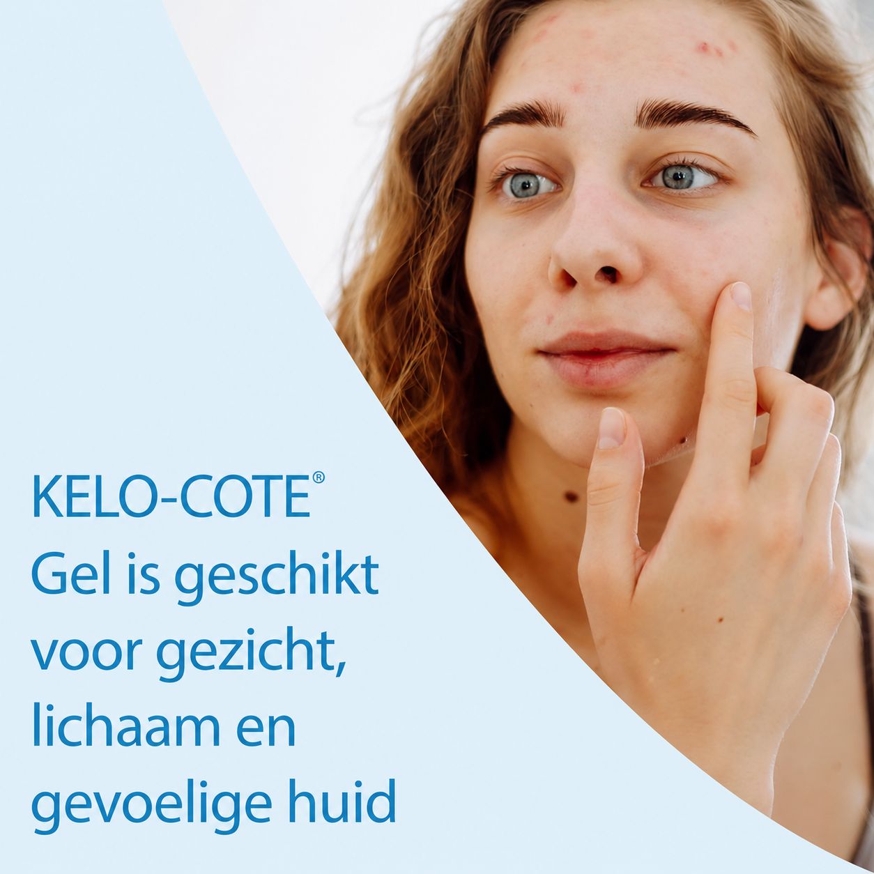 Kelo-Cote tube naast een doosje met informatie over littekenbehandeling.
