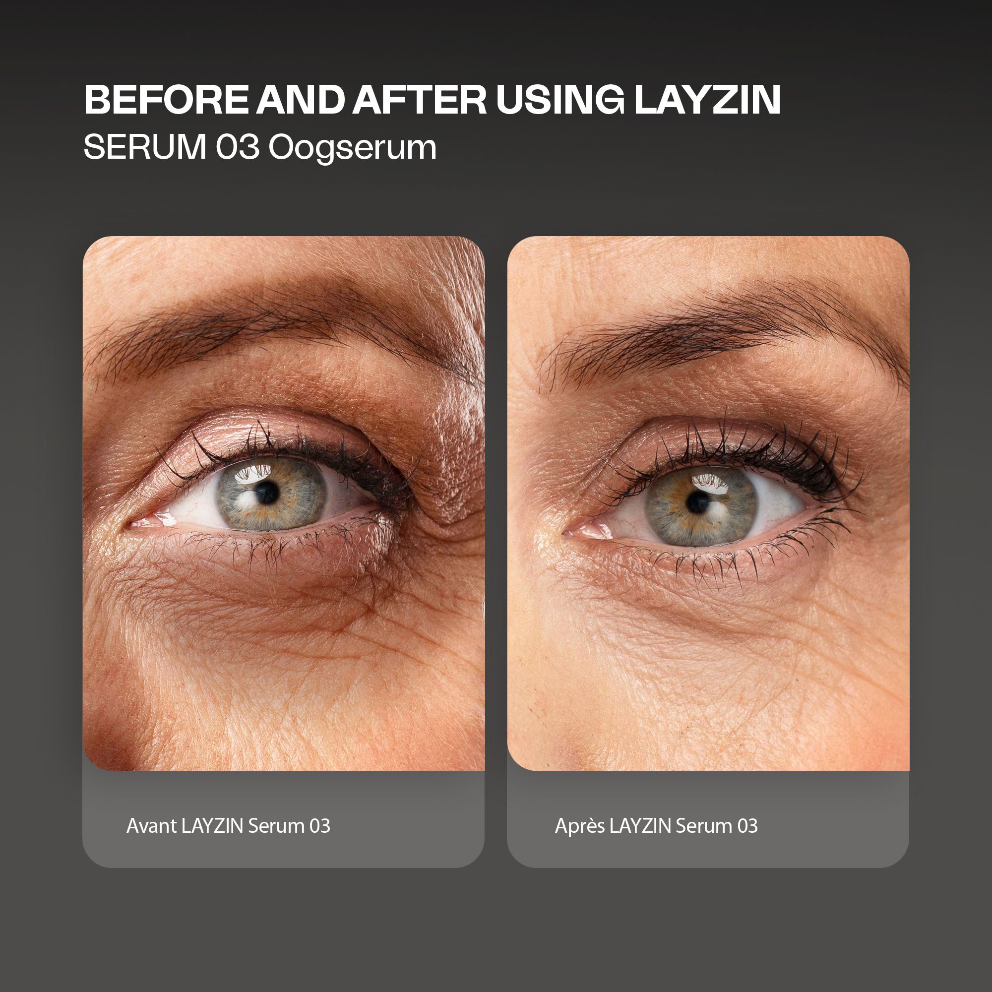Comparaison avant-après des yeux. Gauche : yeux avec cernes. Droite : yeux sans cernes. Texte : LAYZIN Serum 03.