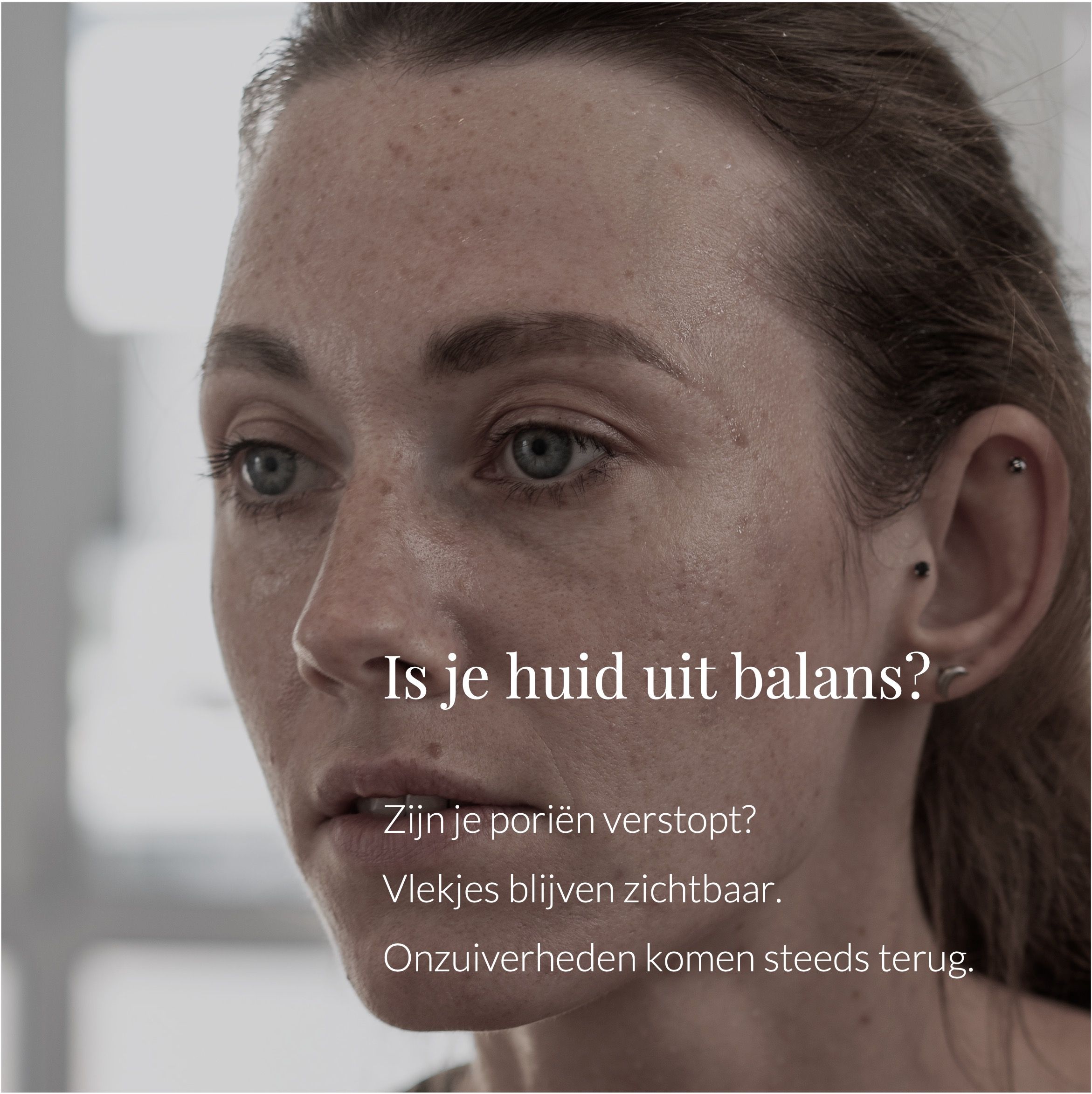 Vrouw met huidonzuiverheden. Tekst: Is je huid uit balans? Tekst over huidproblemen.