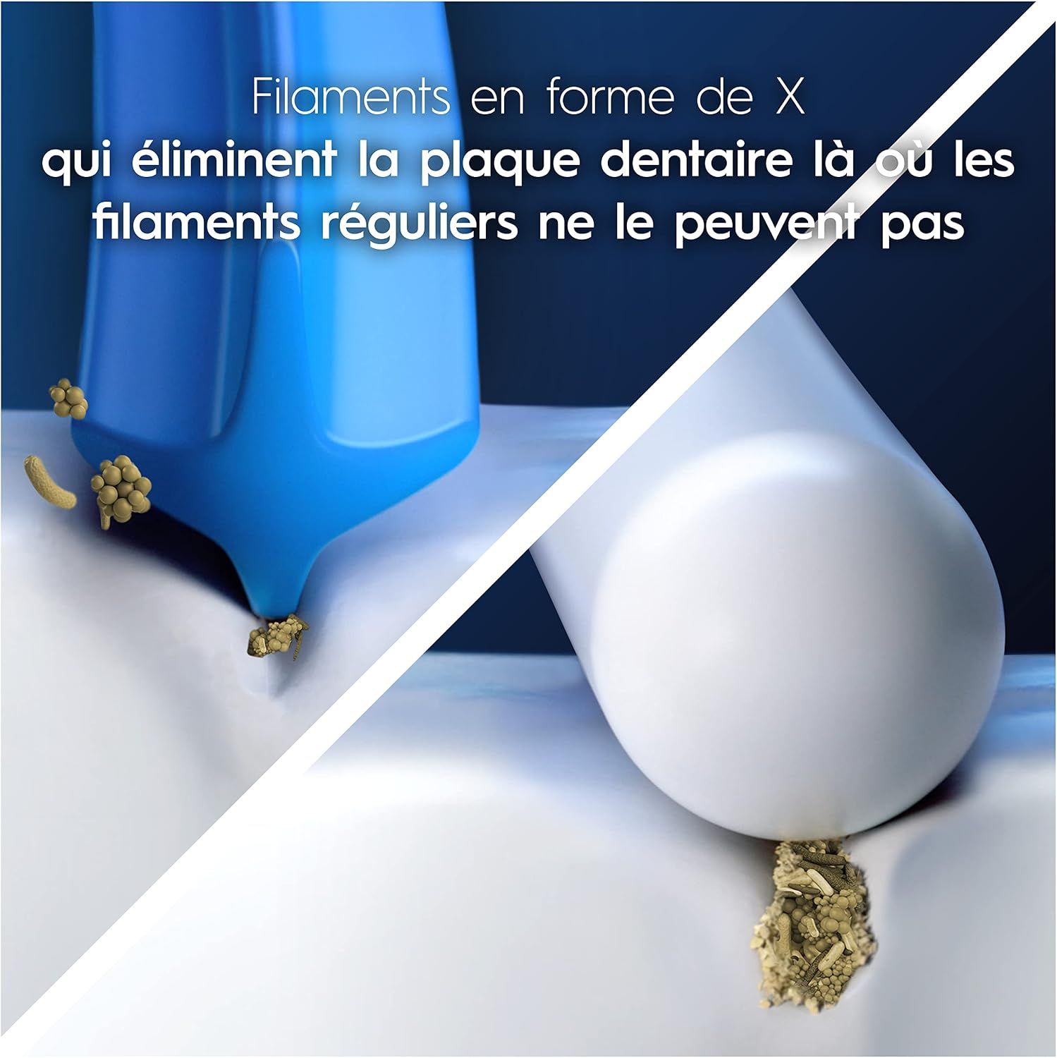Comparaison de têtes de brosse à dents : les poils en X éliminent la plaque dentaire.