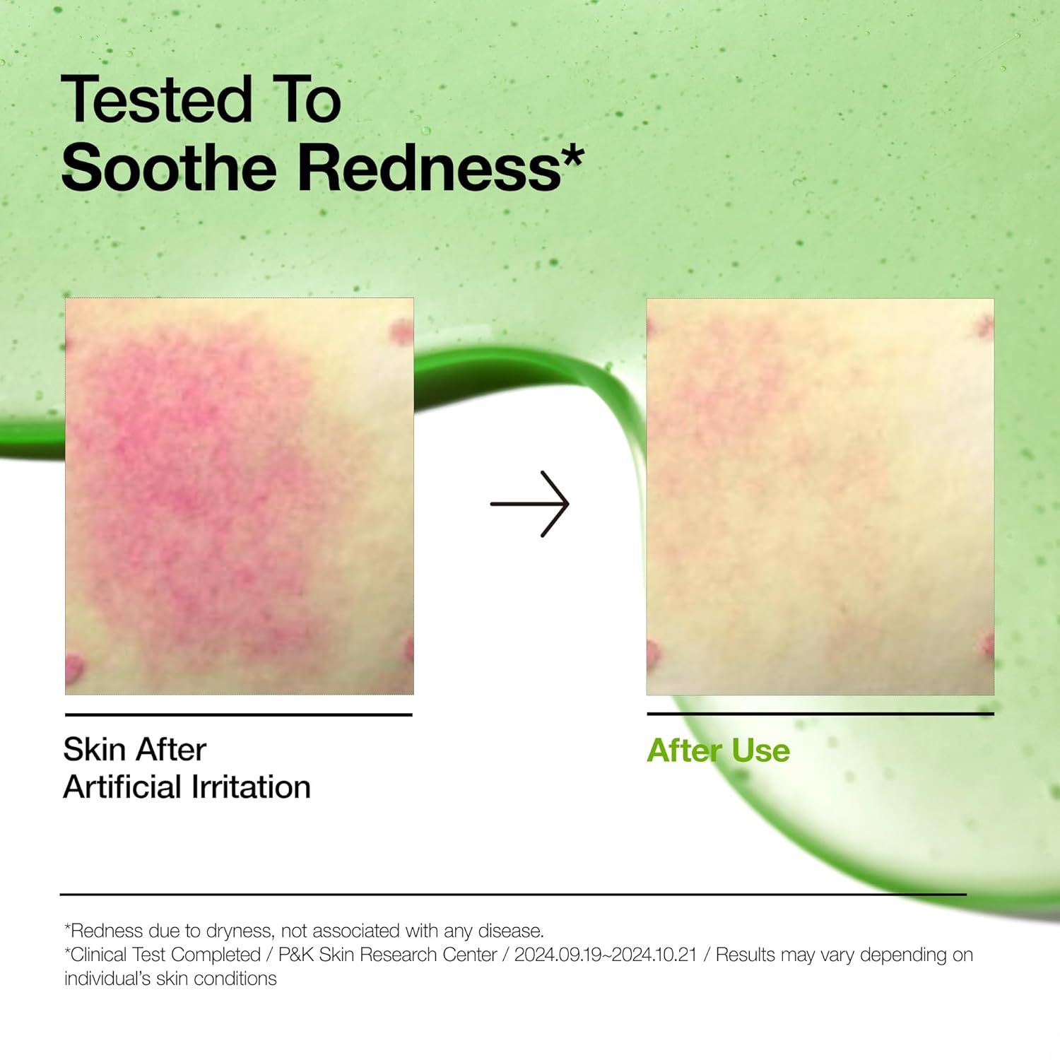 Comparaison avant-après : peau après irritation artificielle et après utilisation du sérum.