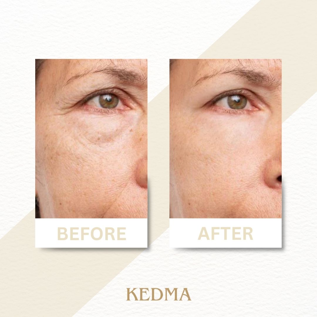 Kedma - Coffret Crème Jour et Nuit au Collagène et Minéraux de la Mer Morte