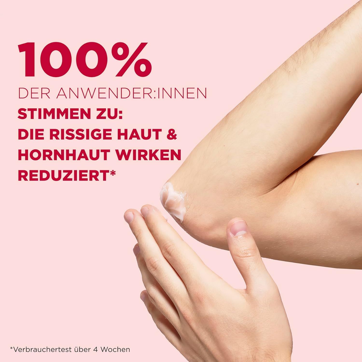 Elleboog met balsem. Tekst: 100% van de gebruikers zijn het erover eens: de gebarsten huid en eelt zijn verminderd.