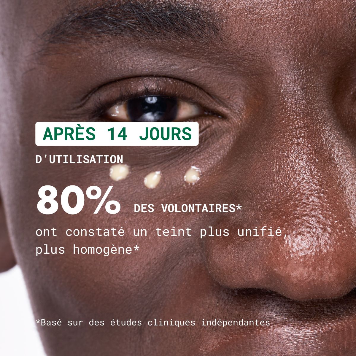 Gezicht met serumapplicatie. Tekst: Na 14 dagen, 80% van de deelnemers constateerden een egalere teint.
