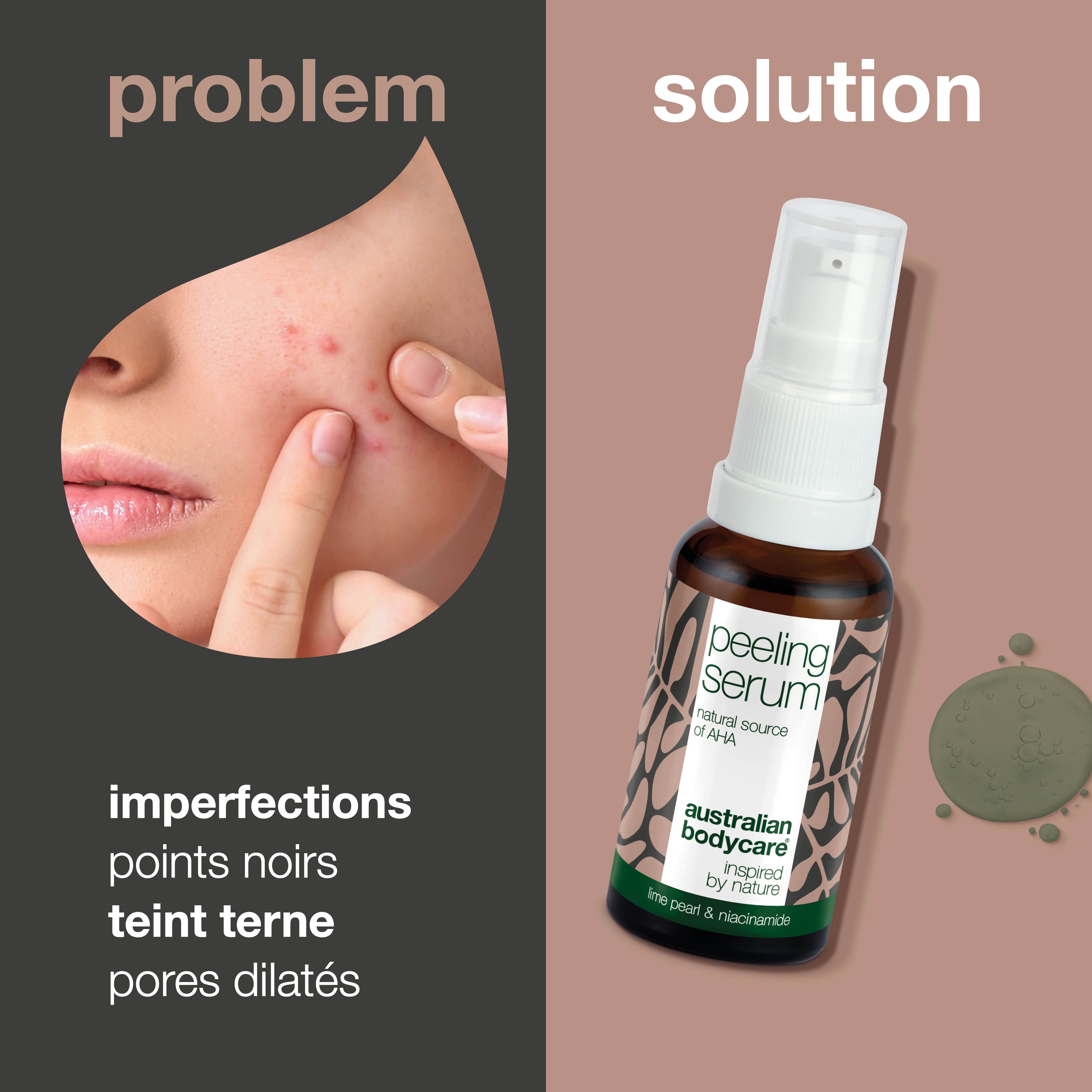 Visage avec boutons. À droite : flacon de sérum peeling. Texte : imperfections, points noirs, teint terne, pores dilatés.