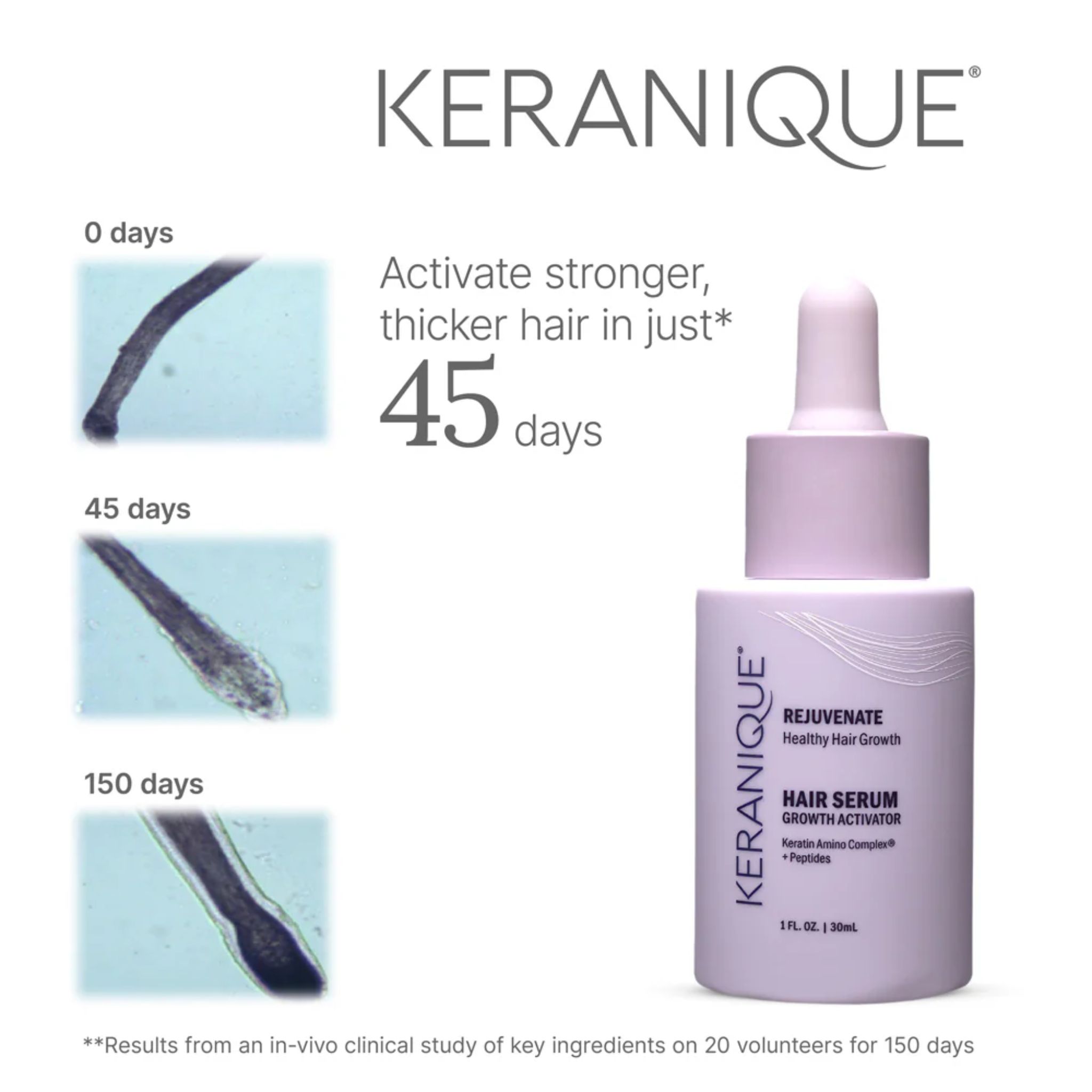 Flacon de sérum Keranique. Montre les changements capillaires après 45 jours. Inscription: Hair Serum Growth Activator.