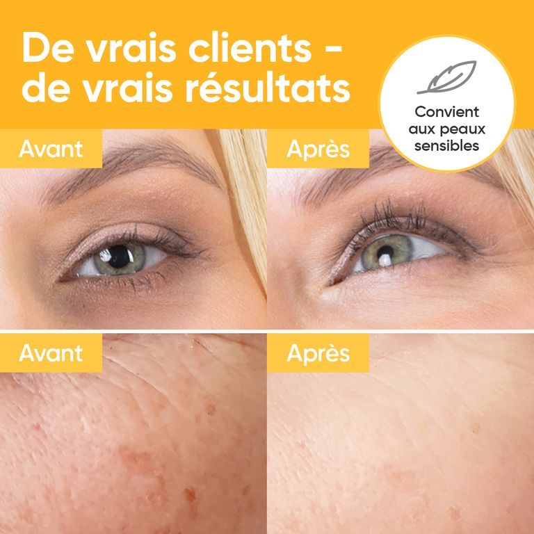 Comparaison avant-après de zones de peau traitées avec le sérum âme pure Retinol & Vitamine C.