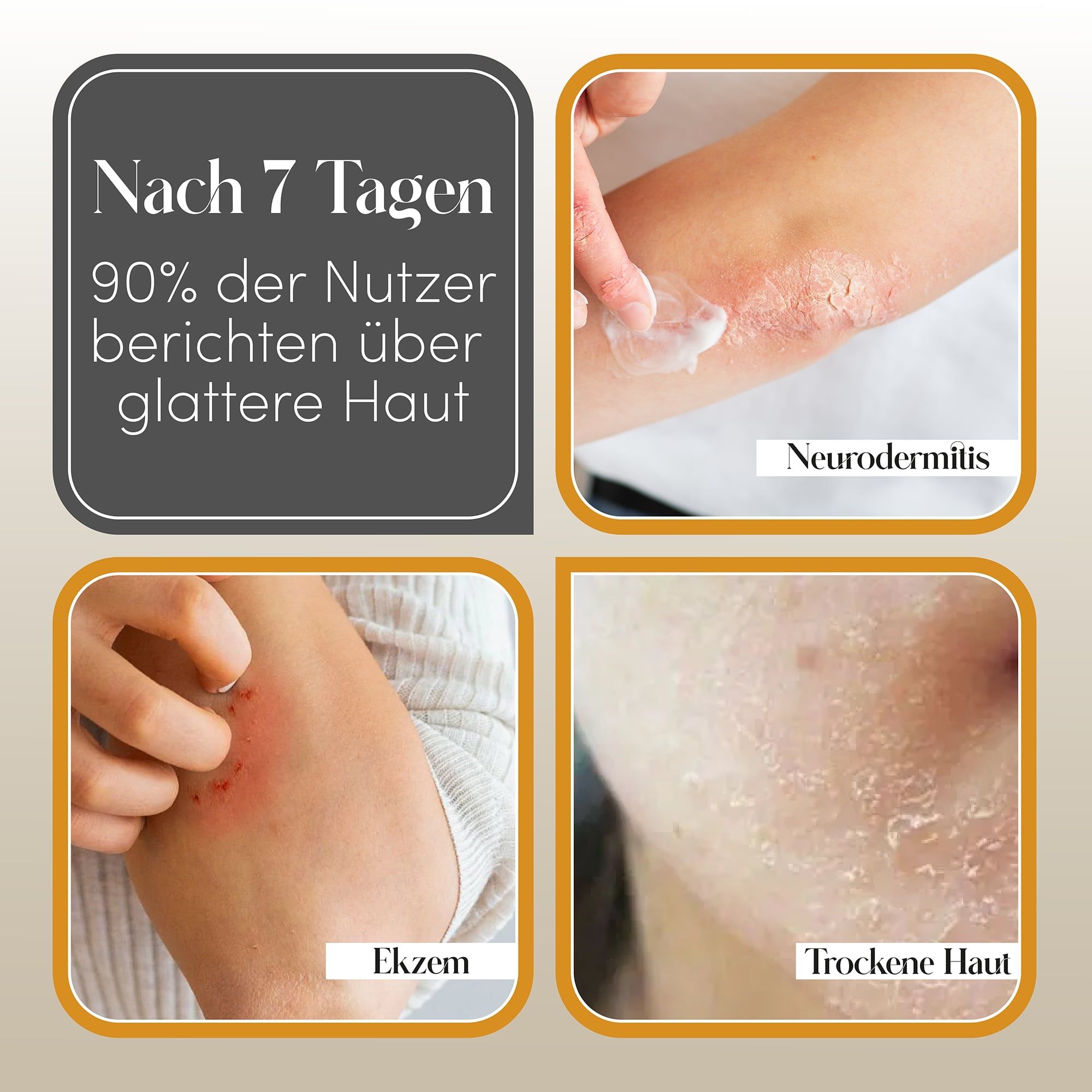 Afbeeldingen van huidproblemen: eczeem, droge huid. Tekst: Na 7 dagen melden 90% van de gebruikers een gladdere huid.