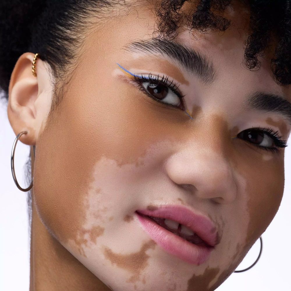Portrait d'une personne avec eyeliner bleu. Peau avec vitiligo. Boucle d'oreille visible.