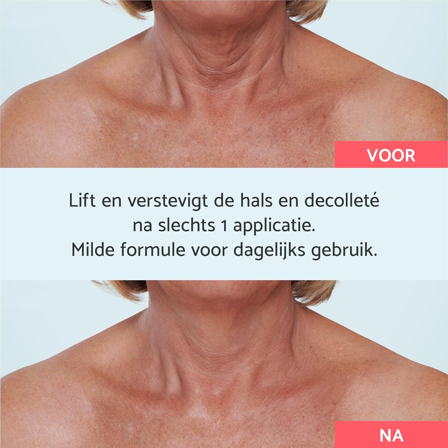 Voor-en-na vergelijking van de huid van nek en decolleté van een vrouw.