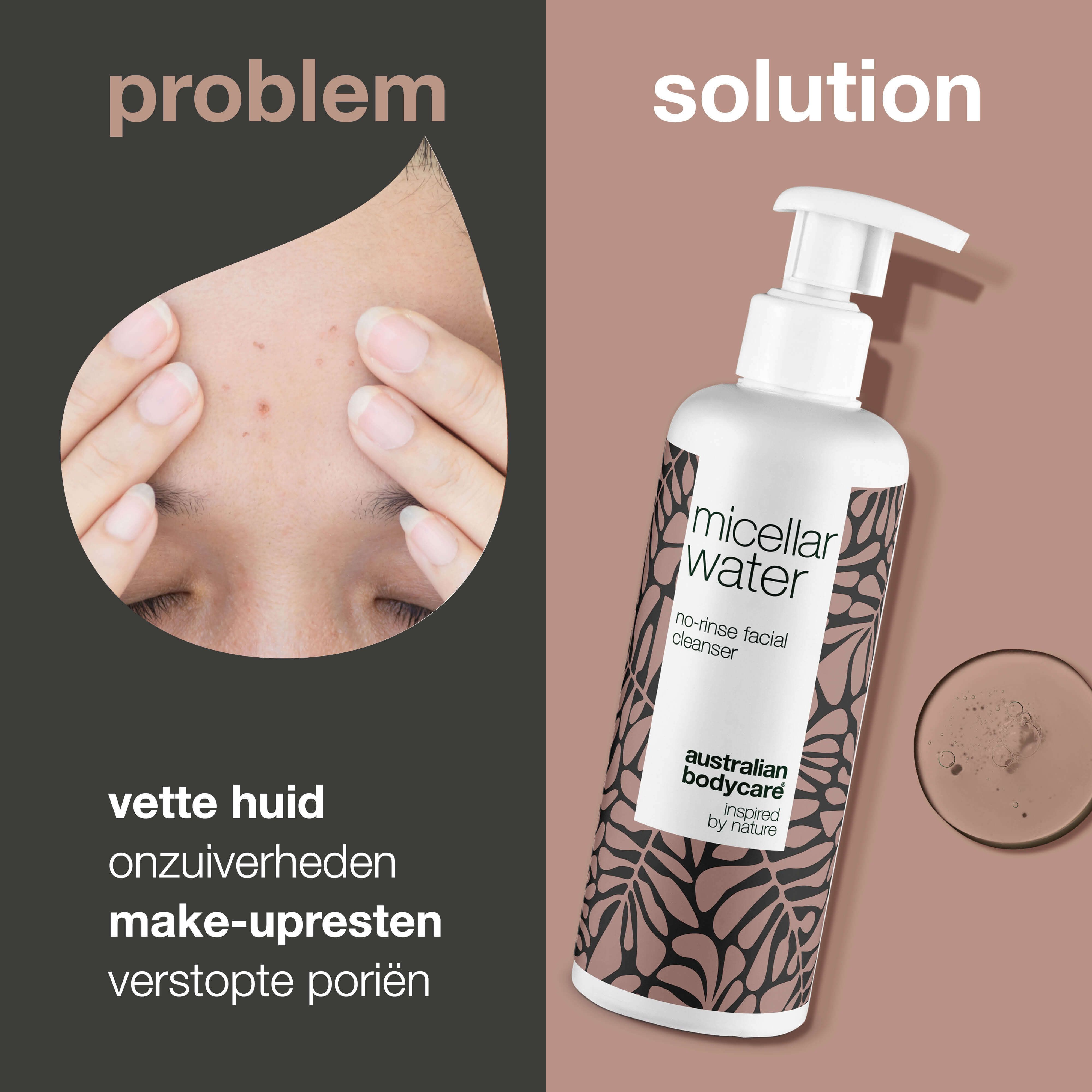 Vergelijking: huidproblemen en oplossing. Fles Micellar Water. Tekst: Australian Bodycare. Probleem: vette huid, onzuiverheden, verstopte poriën.