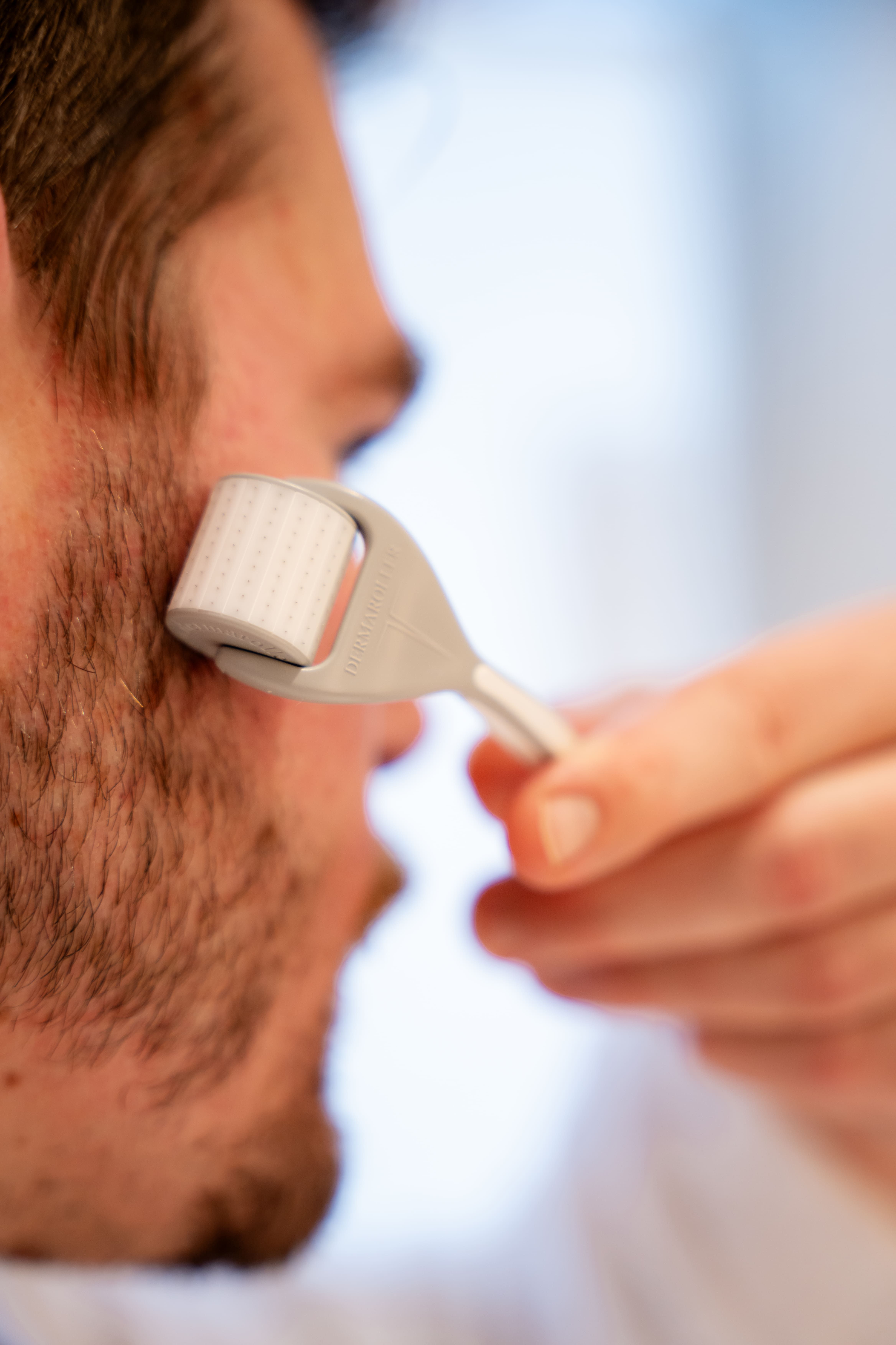 Homme utilisant un dermaroller sur son visage.