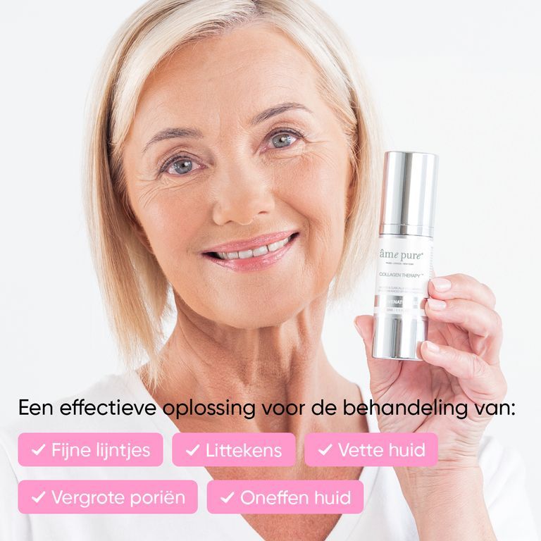 Vrouw met hoofdband gebruikt microneedling gezichtsroller op het voorhoofd.