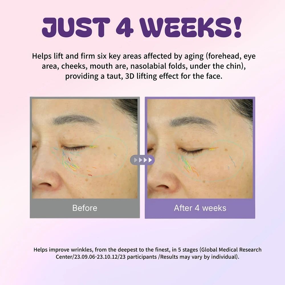 Comparaison avant-après des yeux. Texte: JUST 4 WEEKS! Description des résultats.