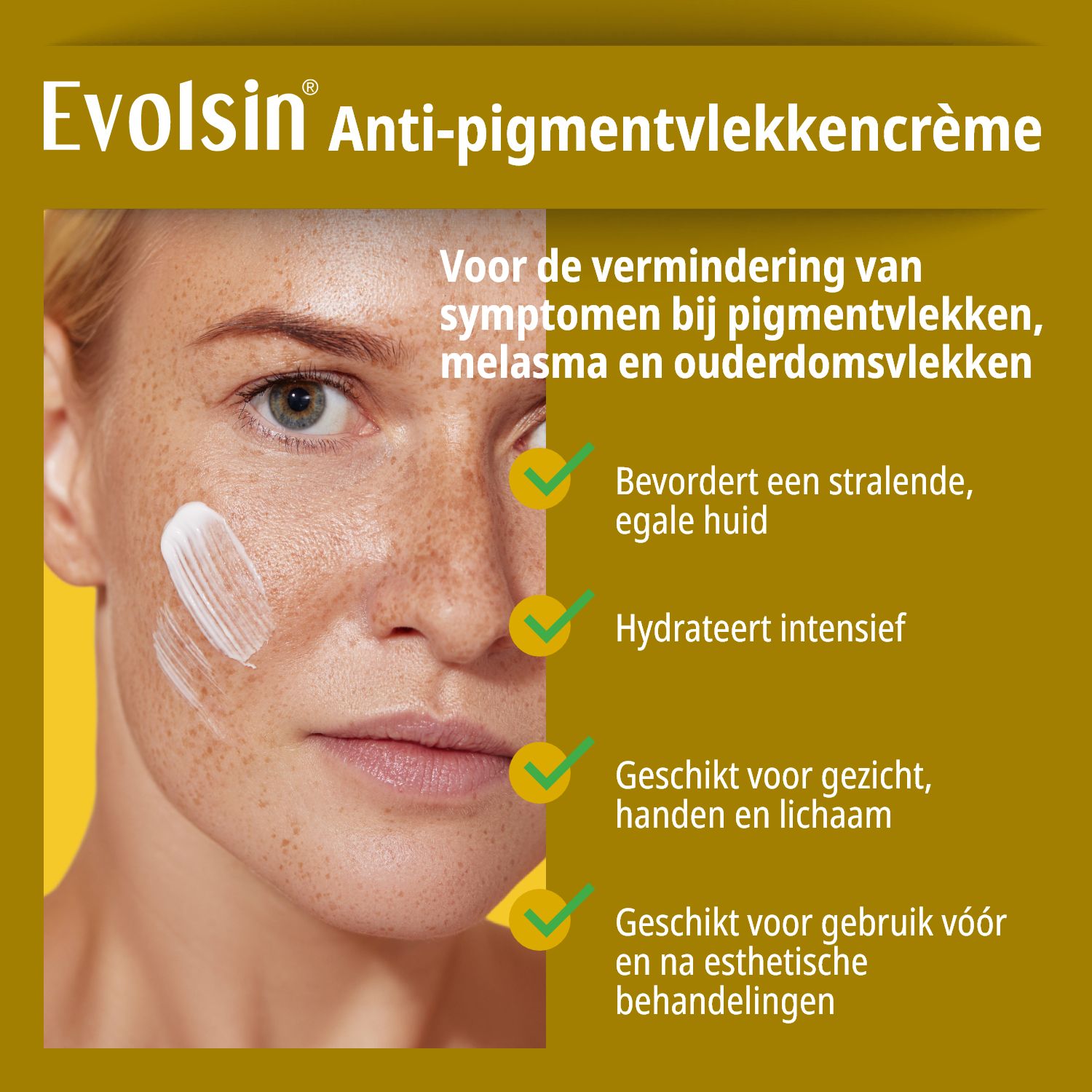 Vrouw met pigmentvlekken. Tekst: Anti-pigmentvlekken crème. Bevordert egale huid, hydrateert. Voor gezicht, handen & lichaam.