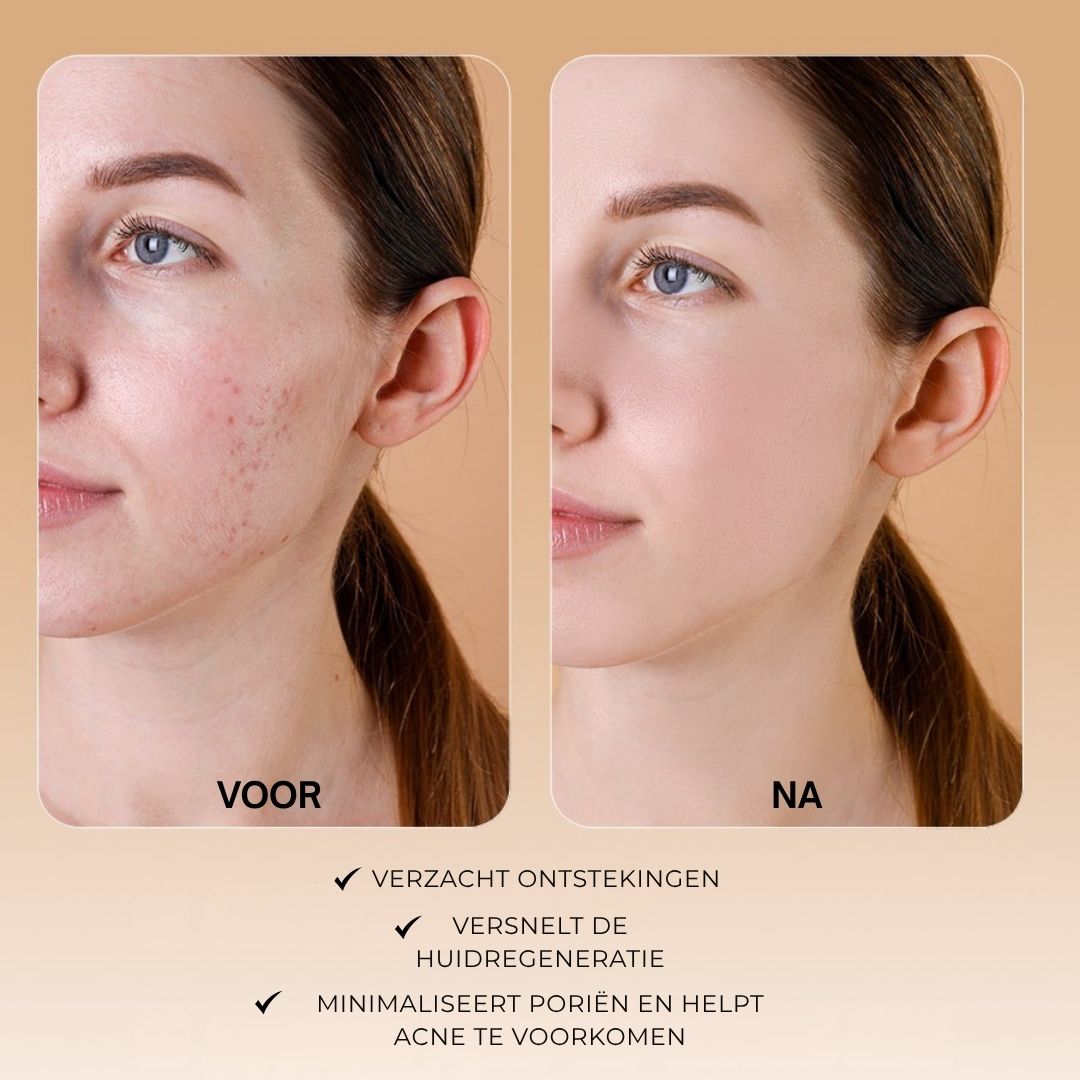 Product met witte pomp. Tekst: Dr. SEA, Mattifying Hamamelis Facial Foam, Azelaic Acid. Ingrediënten.