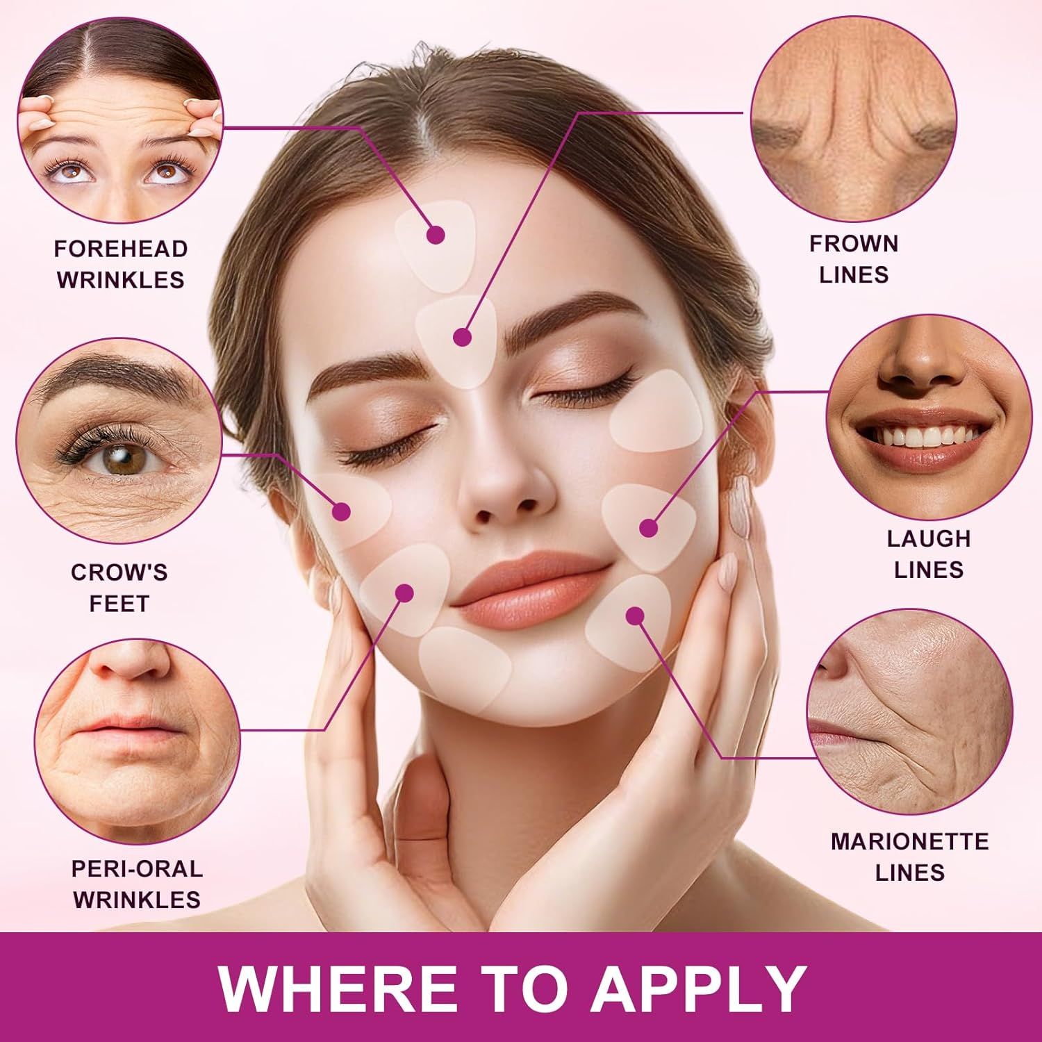 Visage d'une femme avec des patchs anti-rides. Zones : front, pattes d'oie, rides du lion, rides du sourire, plis d'amertume, rides péribuccales.