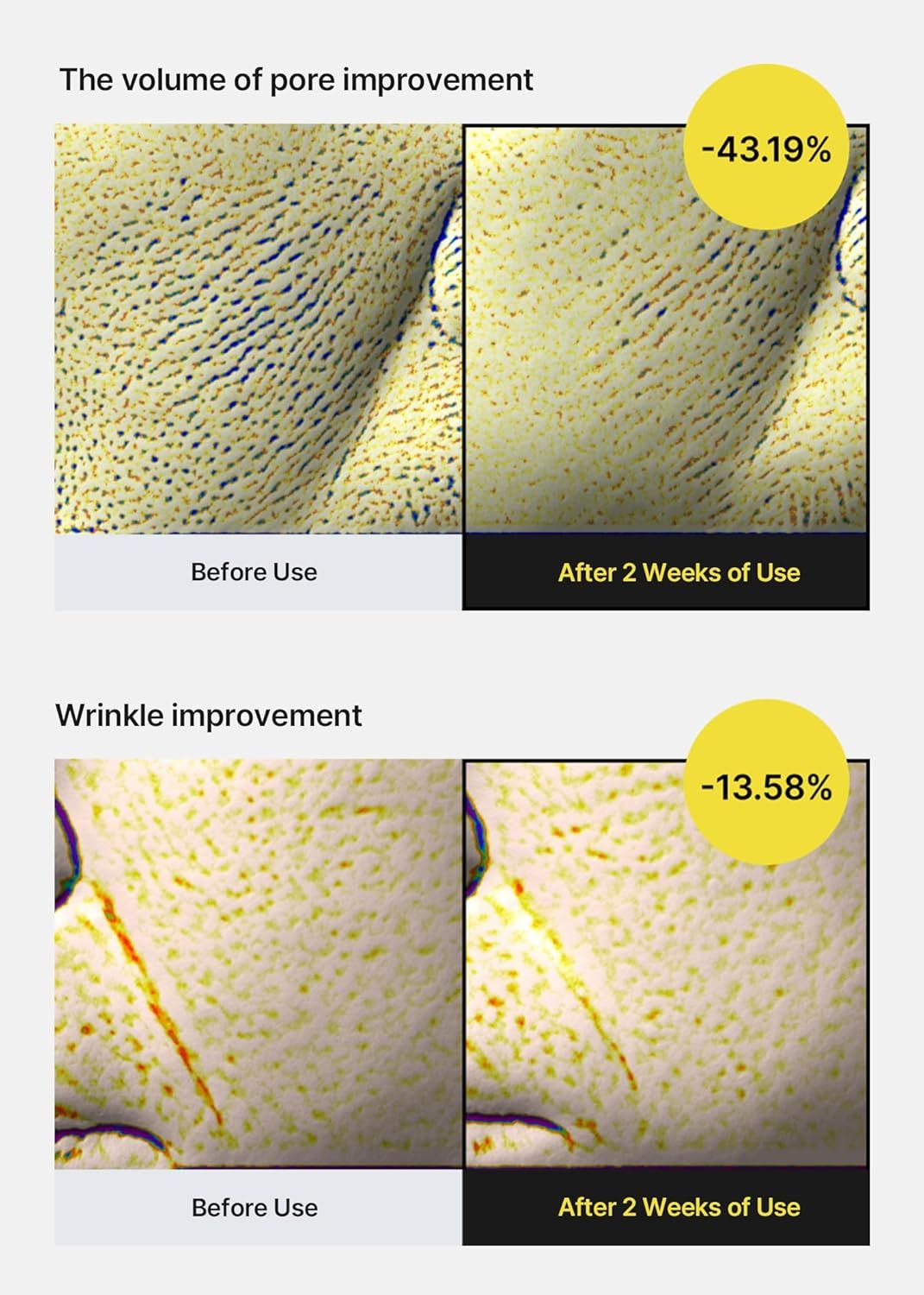 Deux images comparatives. Haut: pores avant et après 2 semaines. Bas: rides avant et après 2 semaines. Pourcentages.