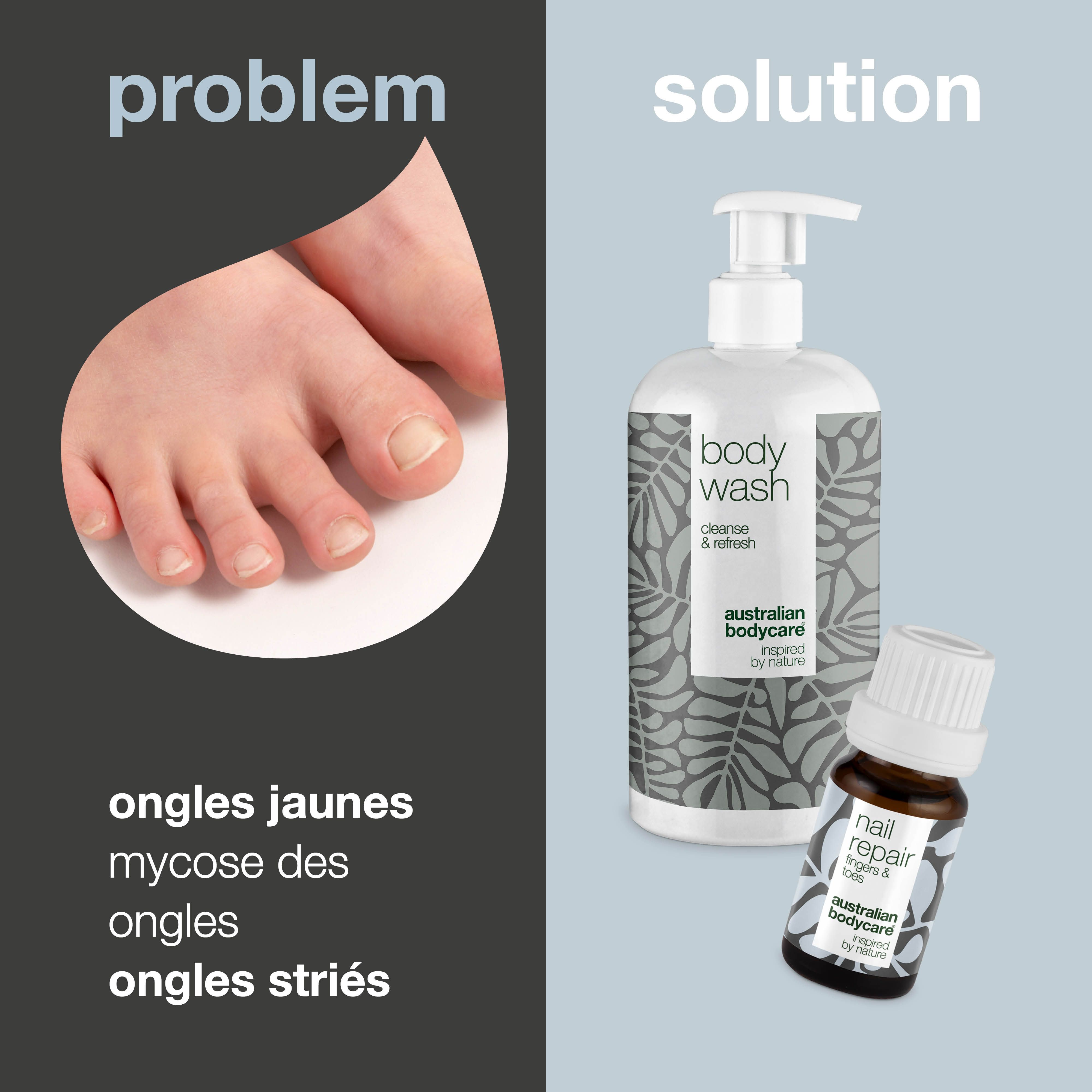 Comparaison problèmes et solutions. Ongles jaunes, mycose, ongles striés. Gel douche et huile ongles.