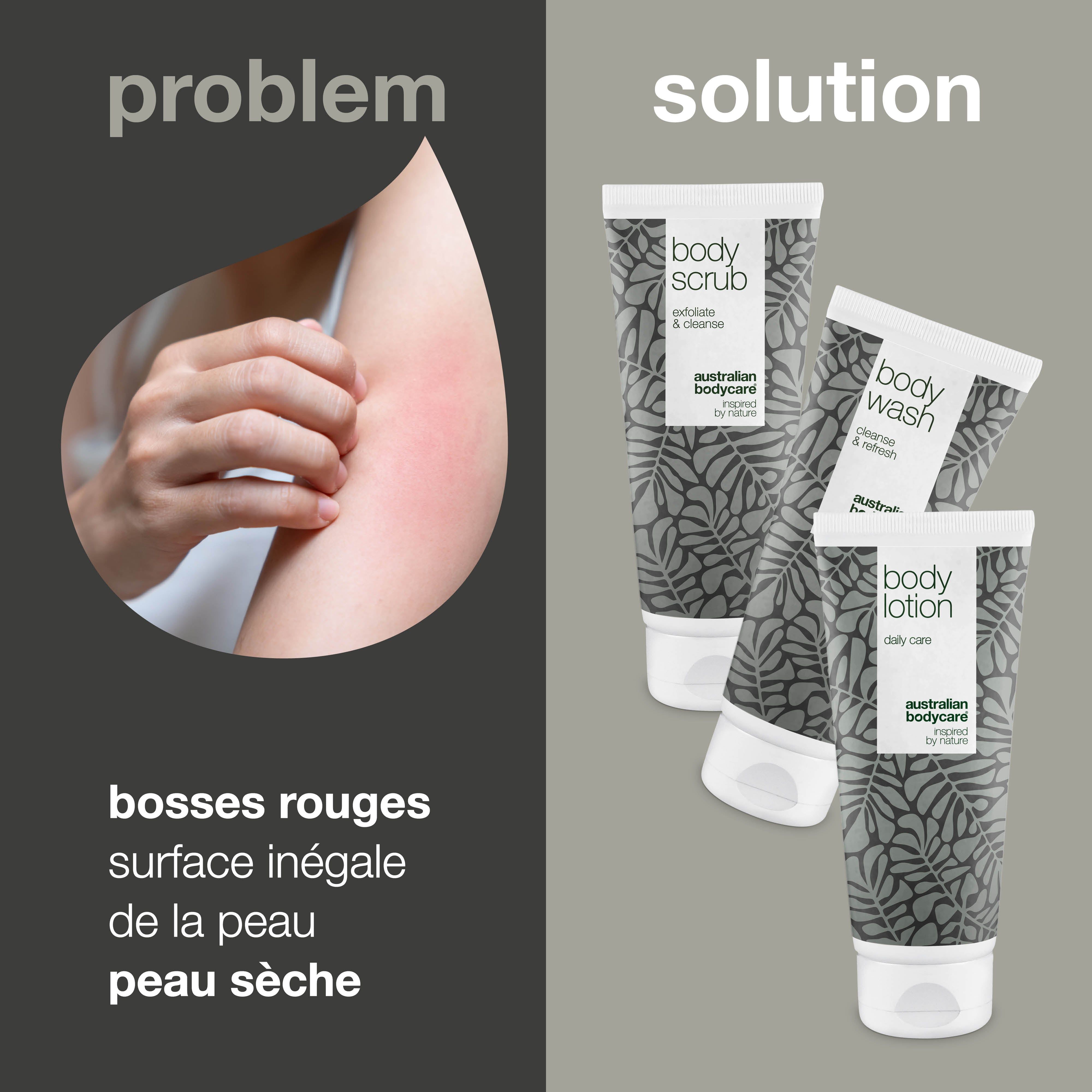 Problème : Boutons rouges, peau inégale, peau sèche. Solution : Trois tubes. Inscriptions : Body Scrub, Body Wash, Body Lotion.