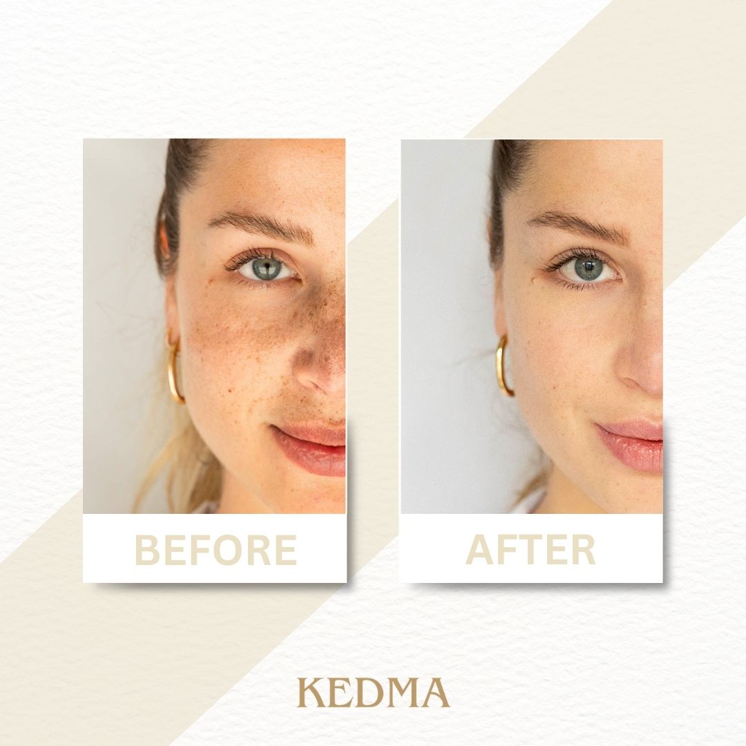 Kedma - Intensieve Nachtcrème met Mineralen uit de Dode Zee en Retinol