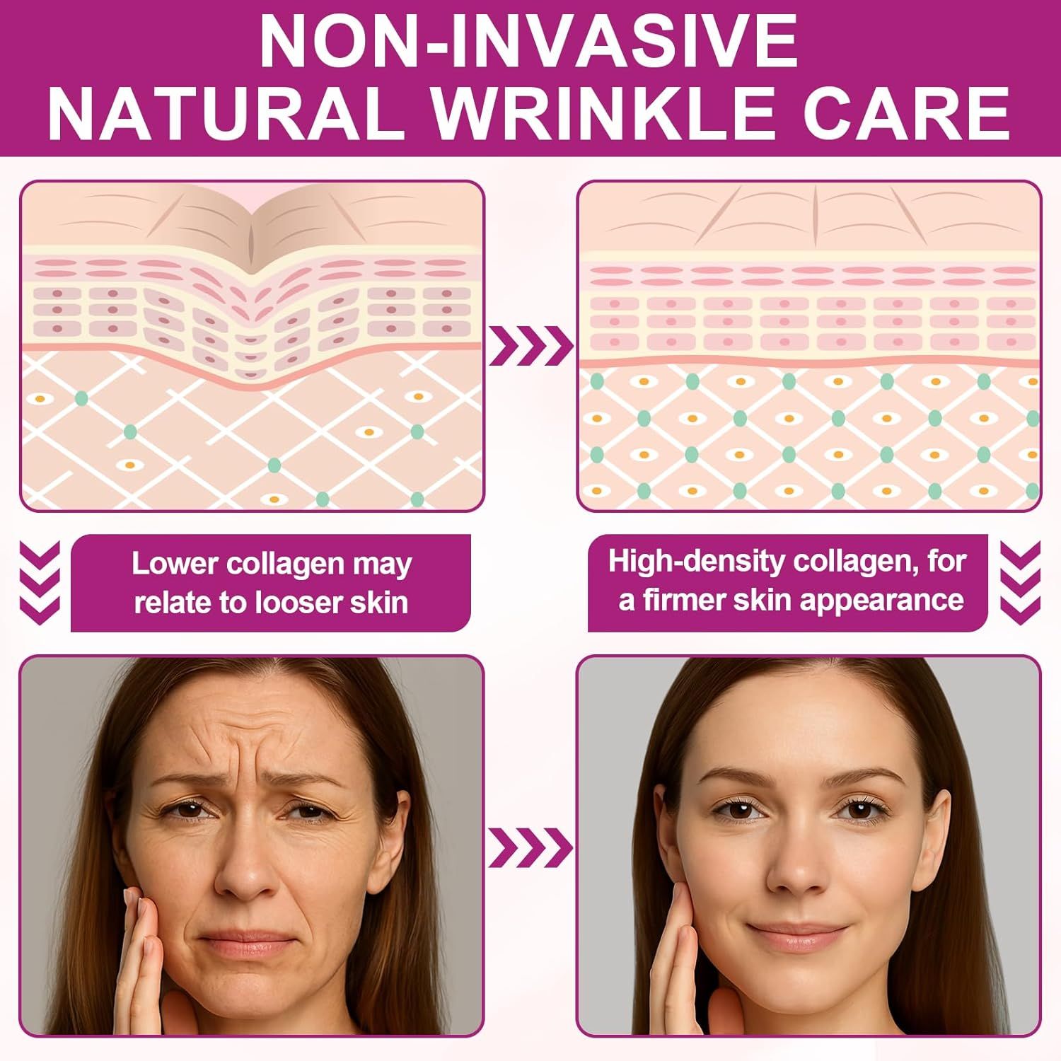 Comparaison avant/après. Texte : Soin naturel non invasif des rides. Moins de collagène, peau plus ferme. Avant : rides. Après : peau plus lisse.