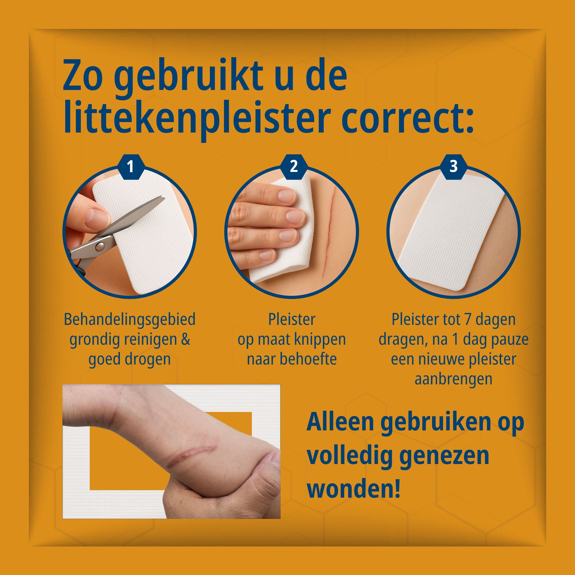 Evolsin® Pansements cicatriciels avec acide hyaluronique – pour cicatrices opératoires, césarienne,