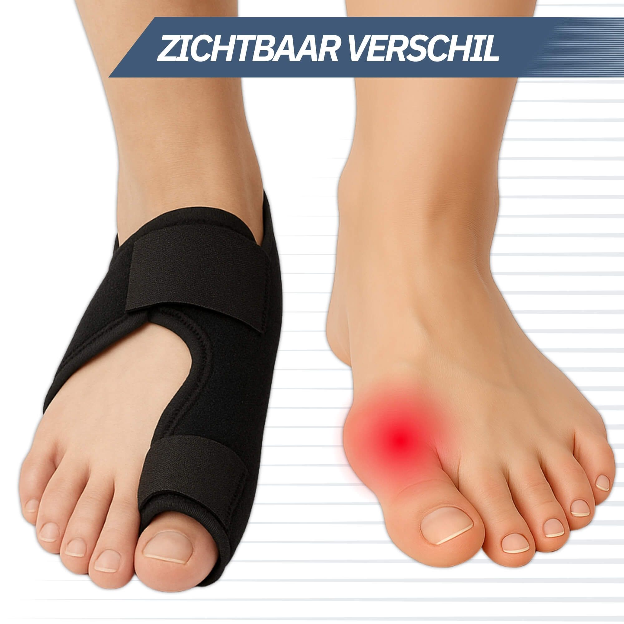 Comparaison : pied avec et sans attelle Hallux Valgus. Point rouge indique zone douloureuse.