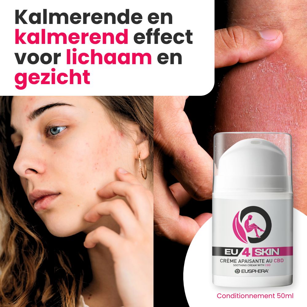 Vrouw met huiduitslag. EU4SKIN crème. Tekst: Kalmerend effect voor lichaam en gezicht. Verpakking 50ml.