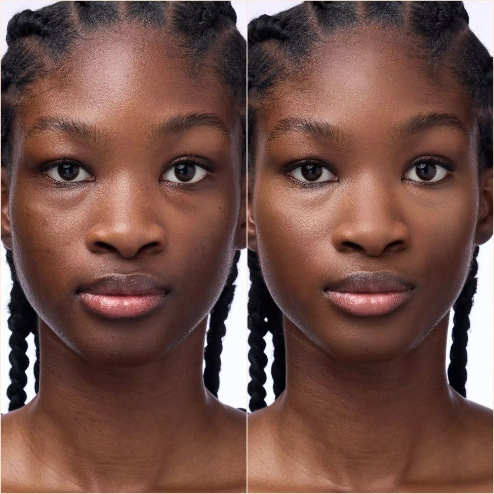 Twee gezichten van een persoon. Links: huidonvolkomenheden. Rechts: gladde huid. Beide gezichten zijn identiek.