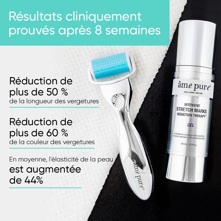 Gros plan d'un rouleau à tête bleue et d'une bouteille de gel argentée.