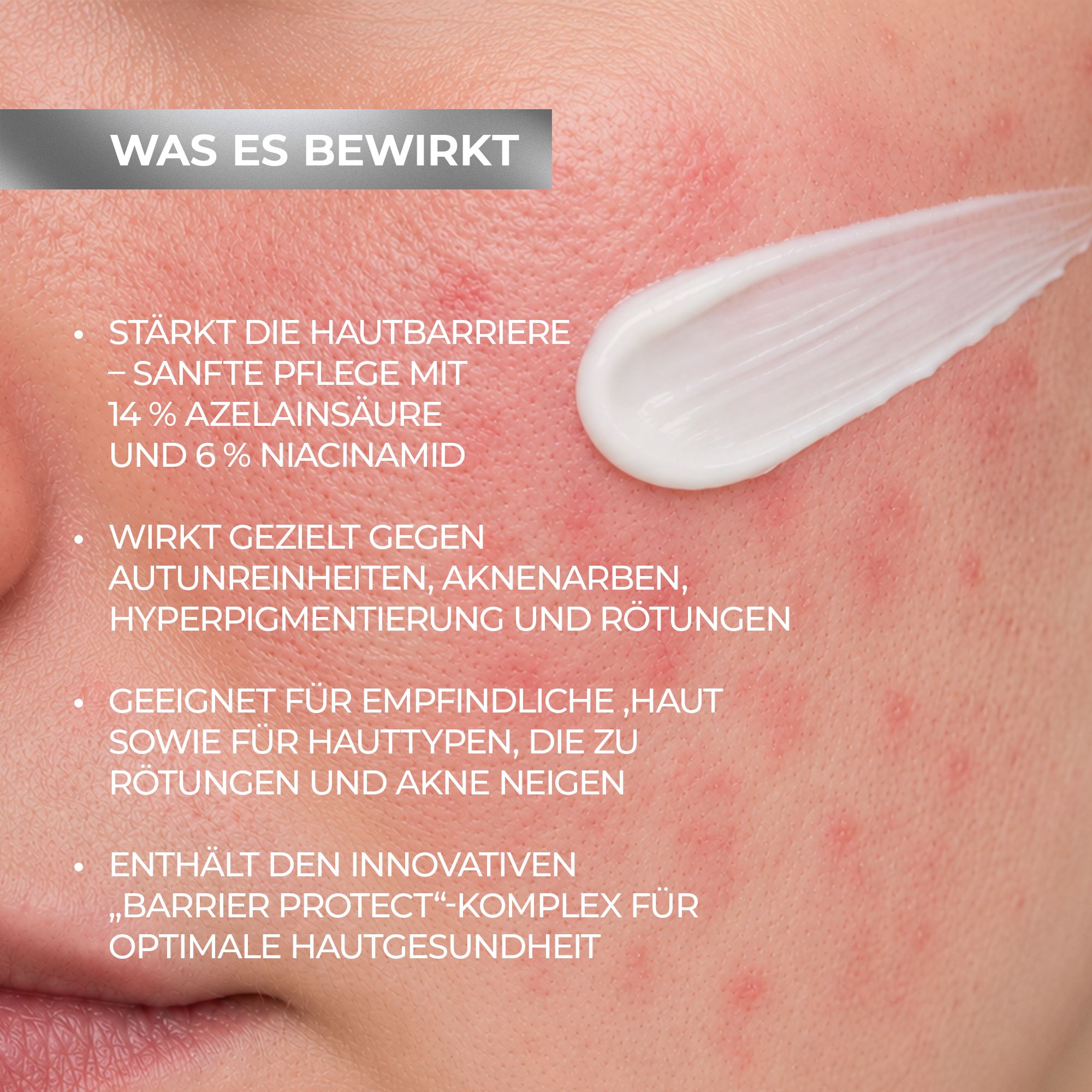 Biotrade AzeB3 Barrier Protect Intensieve verzorgingscrème met azelaïnezuur 14% en niacinamide 6%