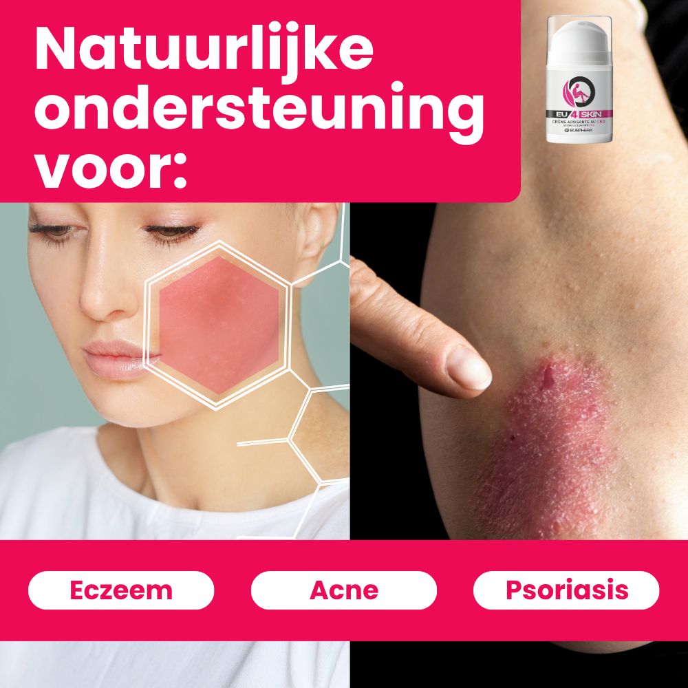 Vrouw en arm met huiduitslag. EU4SKIN crème. Tekst: Ondersteuning bij eczeem, acne, psoriasis.