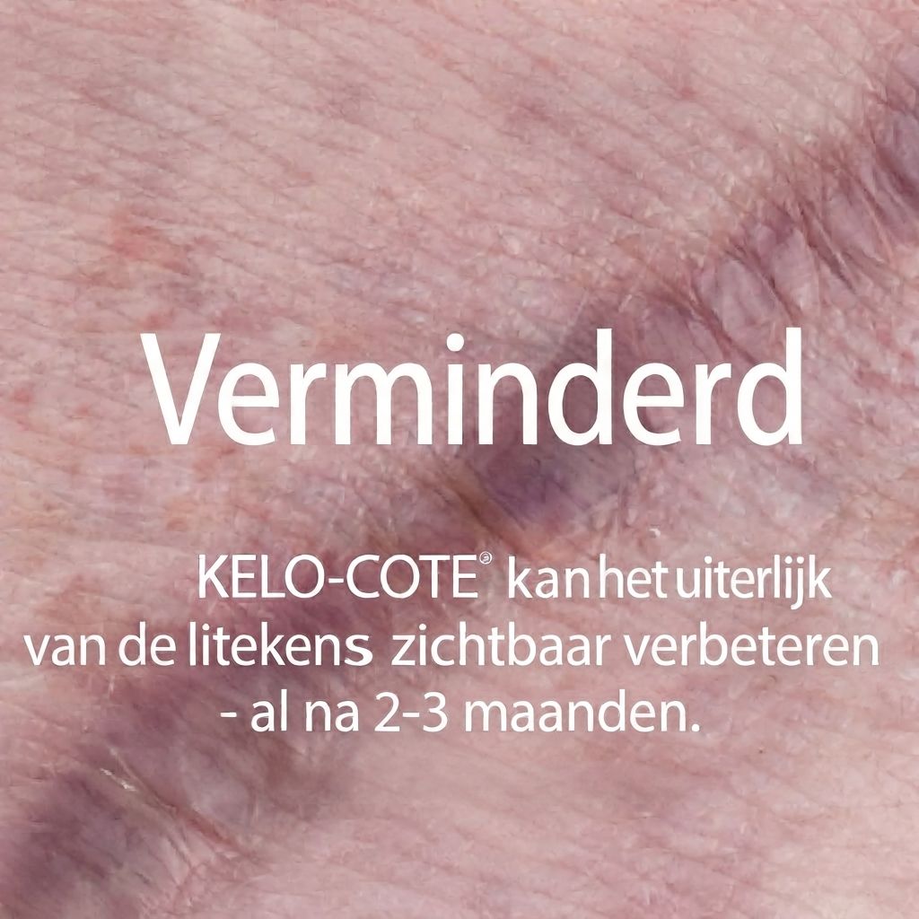 Close-up van een buiklitteken, zichtbaar onder kleding.