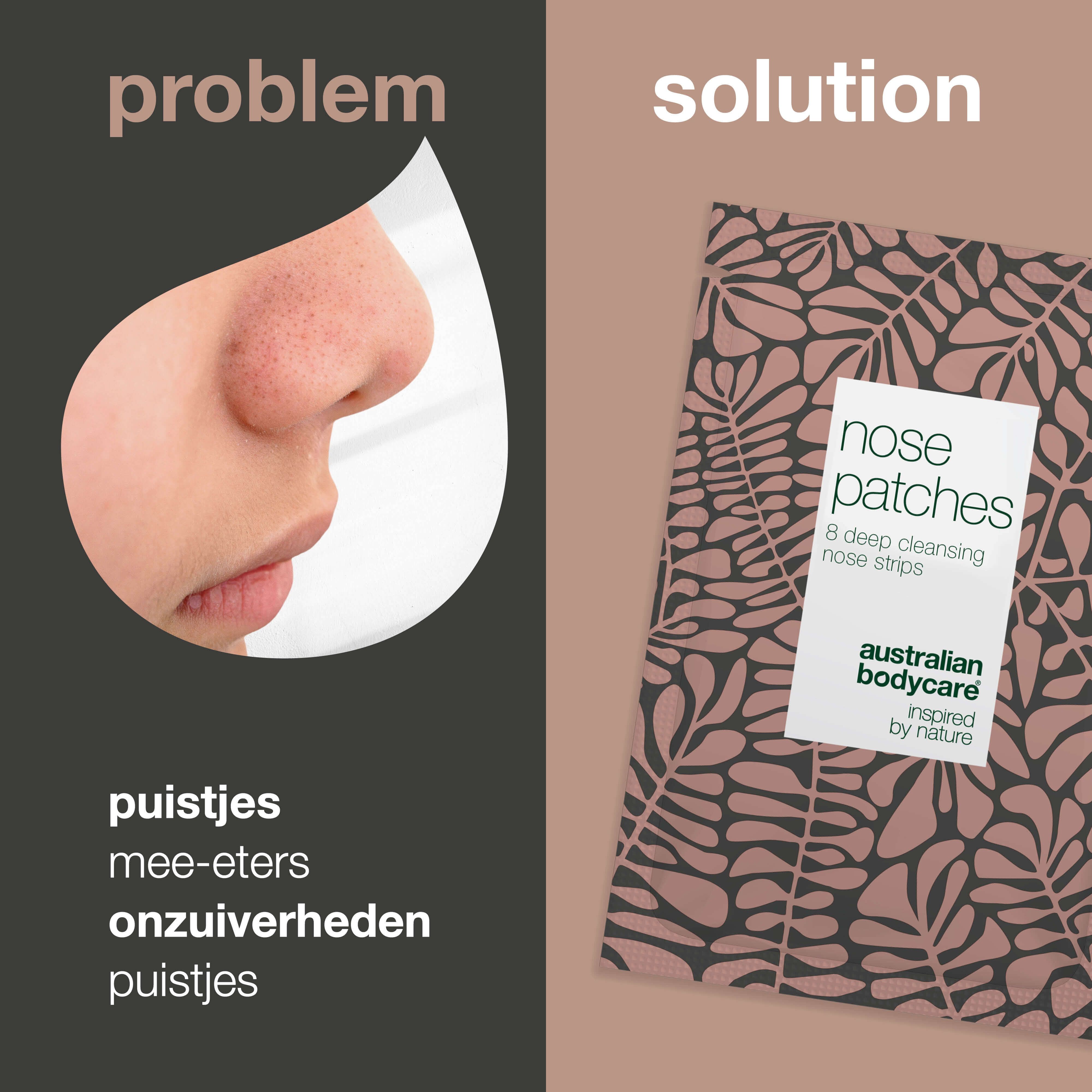 Vergelijking probleem/oplossing. Gezicht met onzuiverheden. Verpakking met neusstrips. Merk: Australian Bodycare.