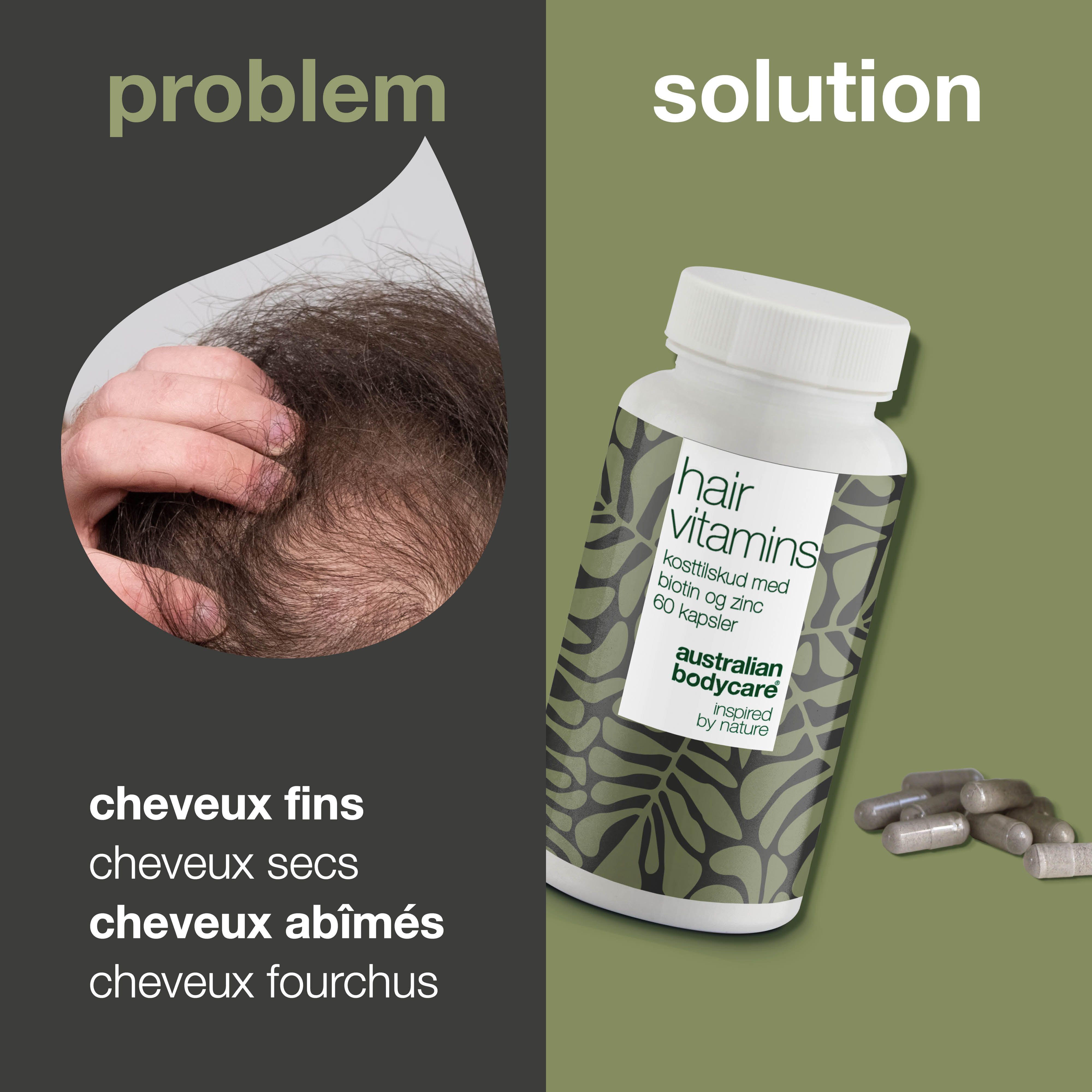 Comparaison des problèmes et des solutions. Un flacon "hair vitamins" et des gélules sont visibles.