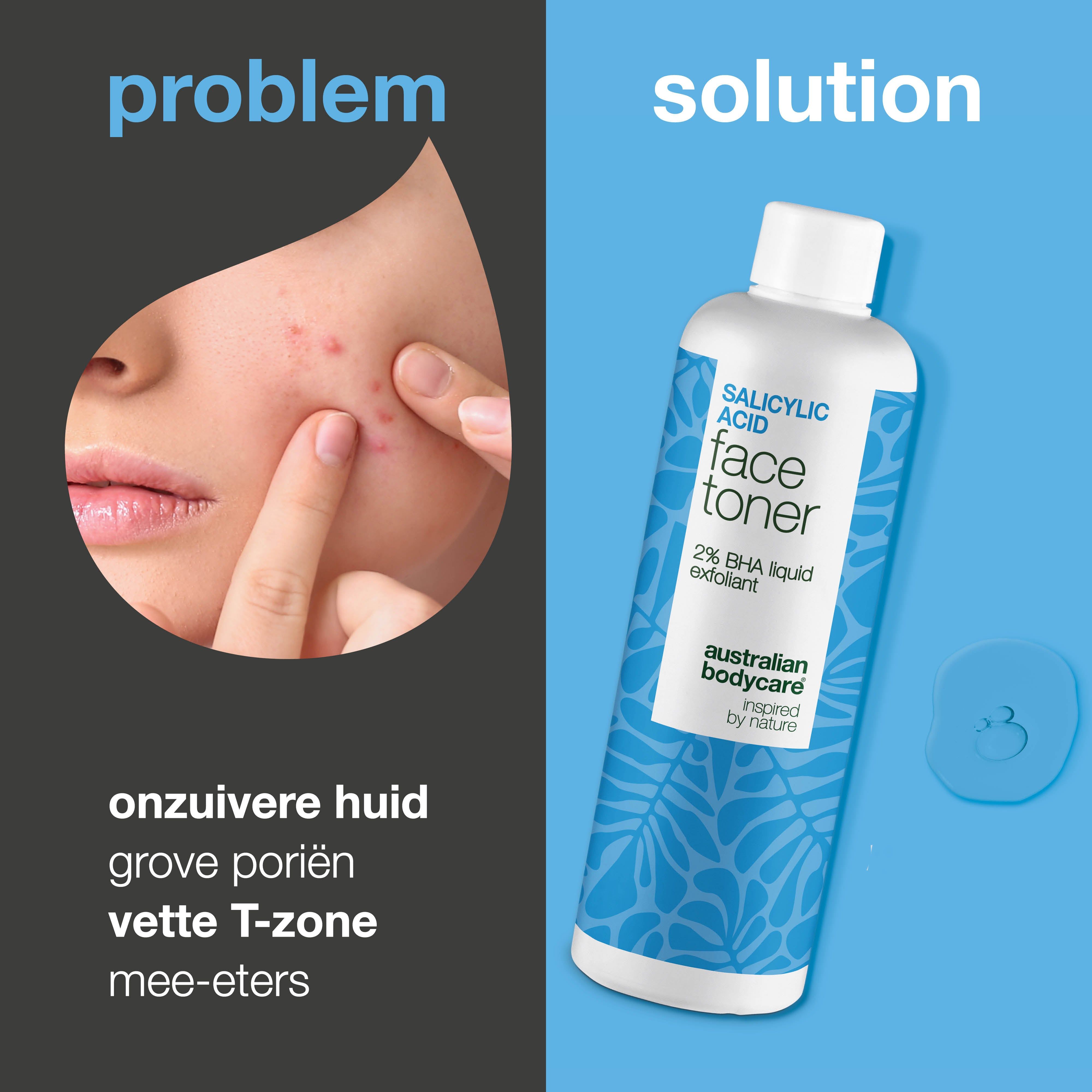 Gezicht met huidonzuiverheden. Daarnaast fles met opschrift: Salicylic Acid Face Toner. Tekst: Probleem, Oplossing.