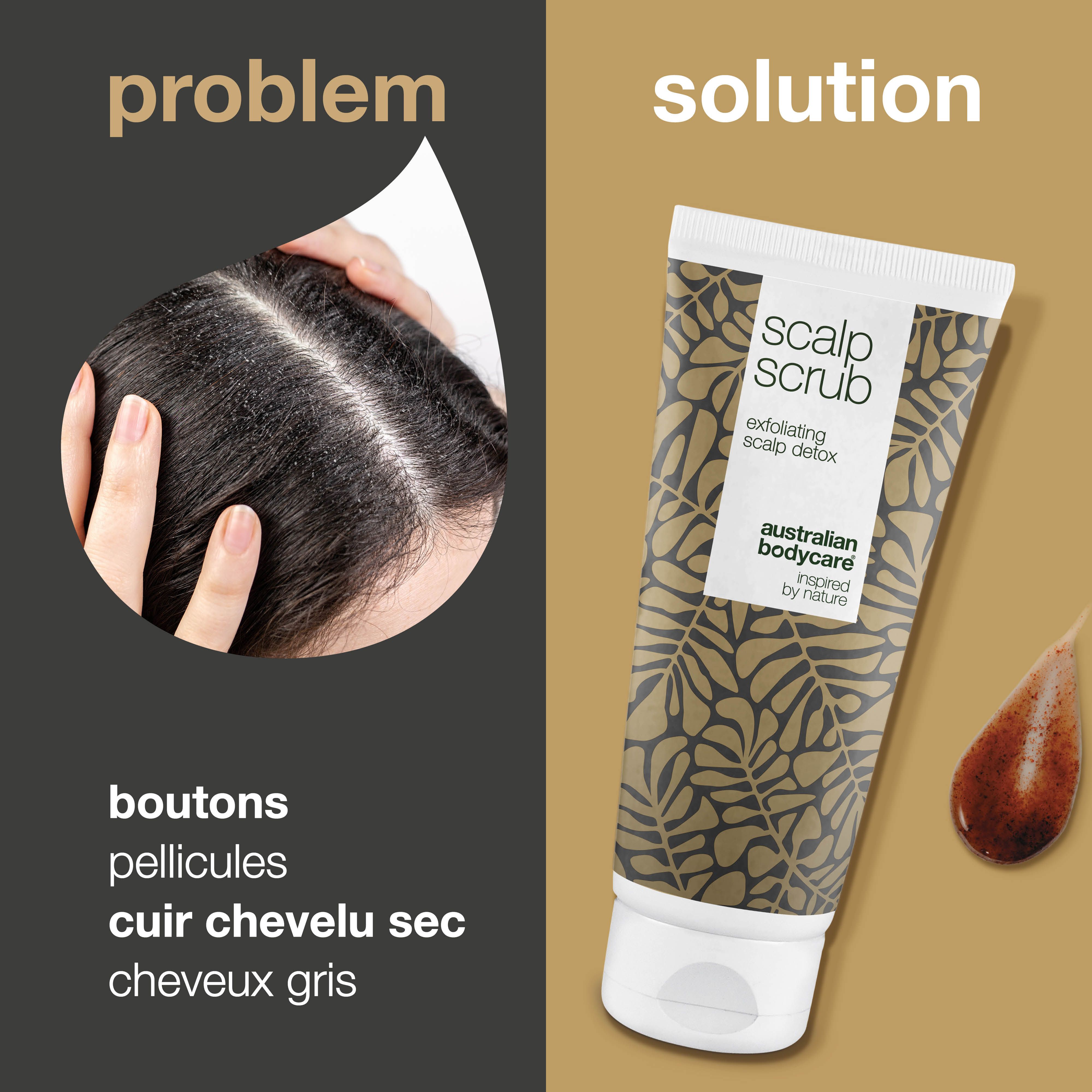 Tube de produit et vue du cuir chevelu. Texte : Problème/Solution. Problèmes : boutons, pellicules, cuir chevelu sec, cheveux gras.