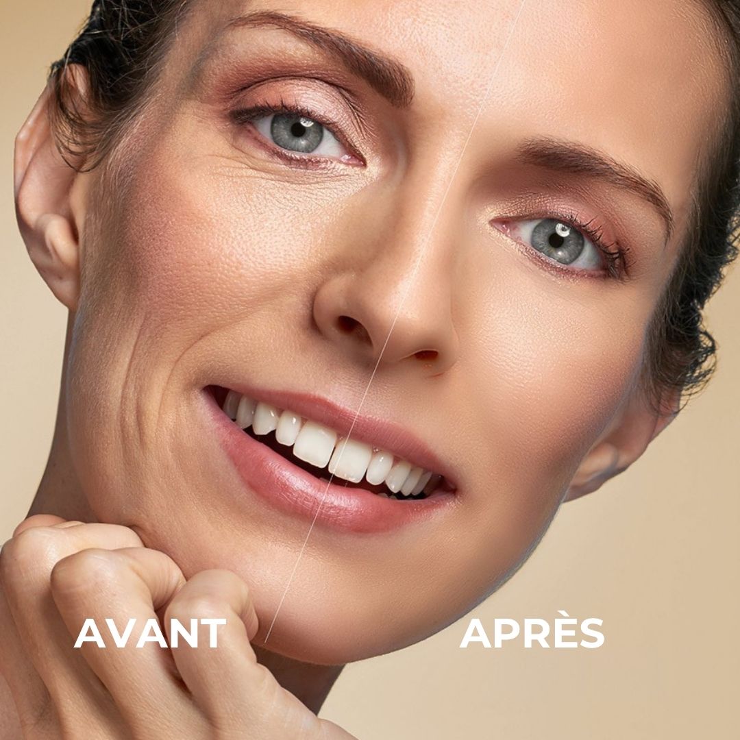 Comparaison avant-après. Femme avec rides, puis peau plus lisse. Pot de crème avec couvercle orange.