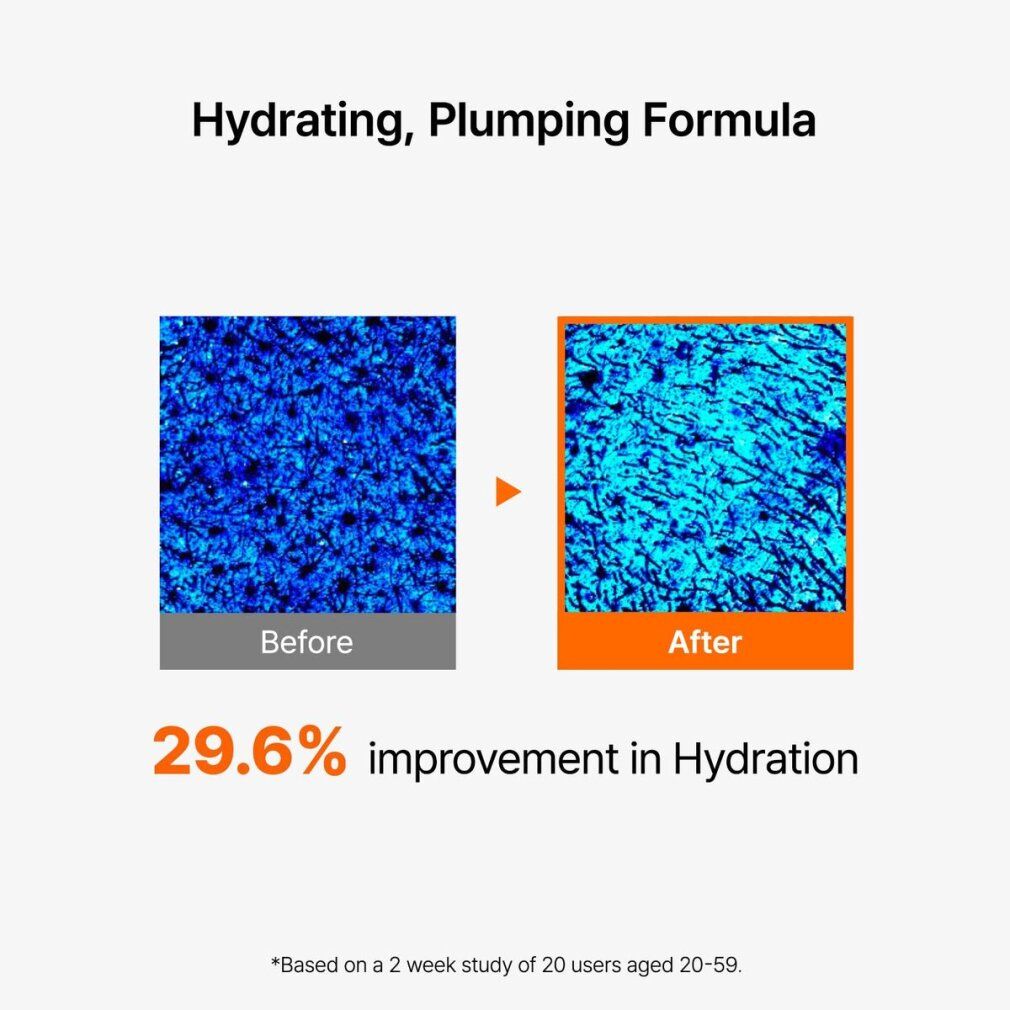 Vergelijkingsafbeelding: huid voor en na. 29,6% verbetering van hydratatie. Tekst: Hydraterende, opvullende formule.