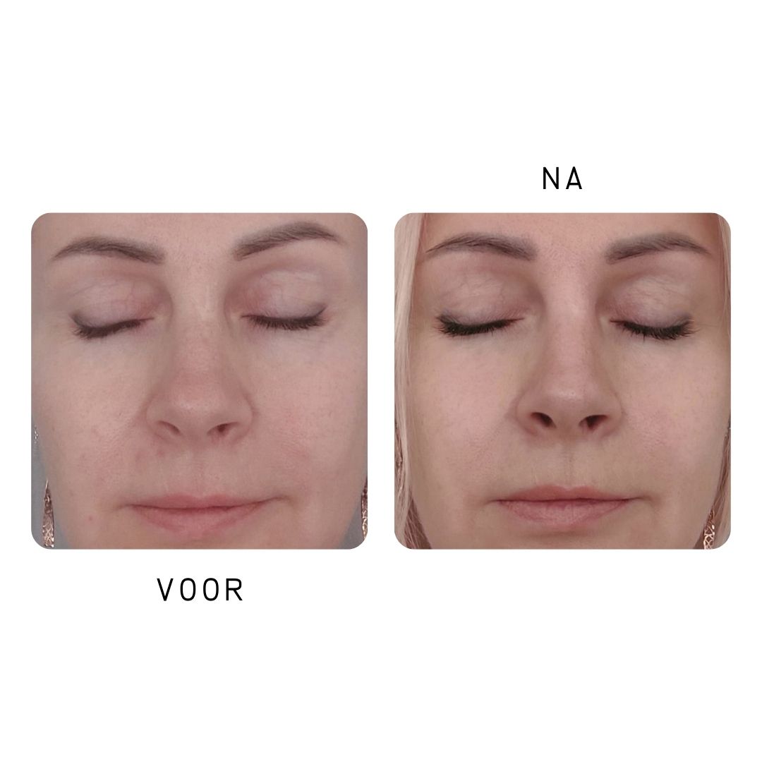 SEAMANTIKA - Peeling Gel Papaja