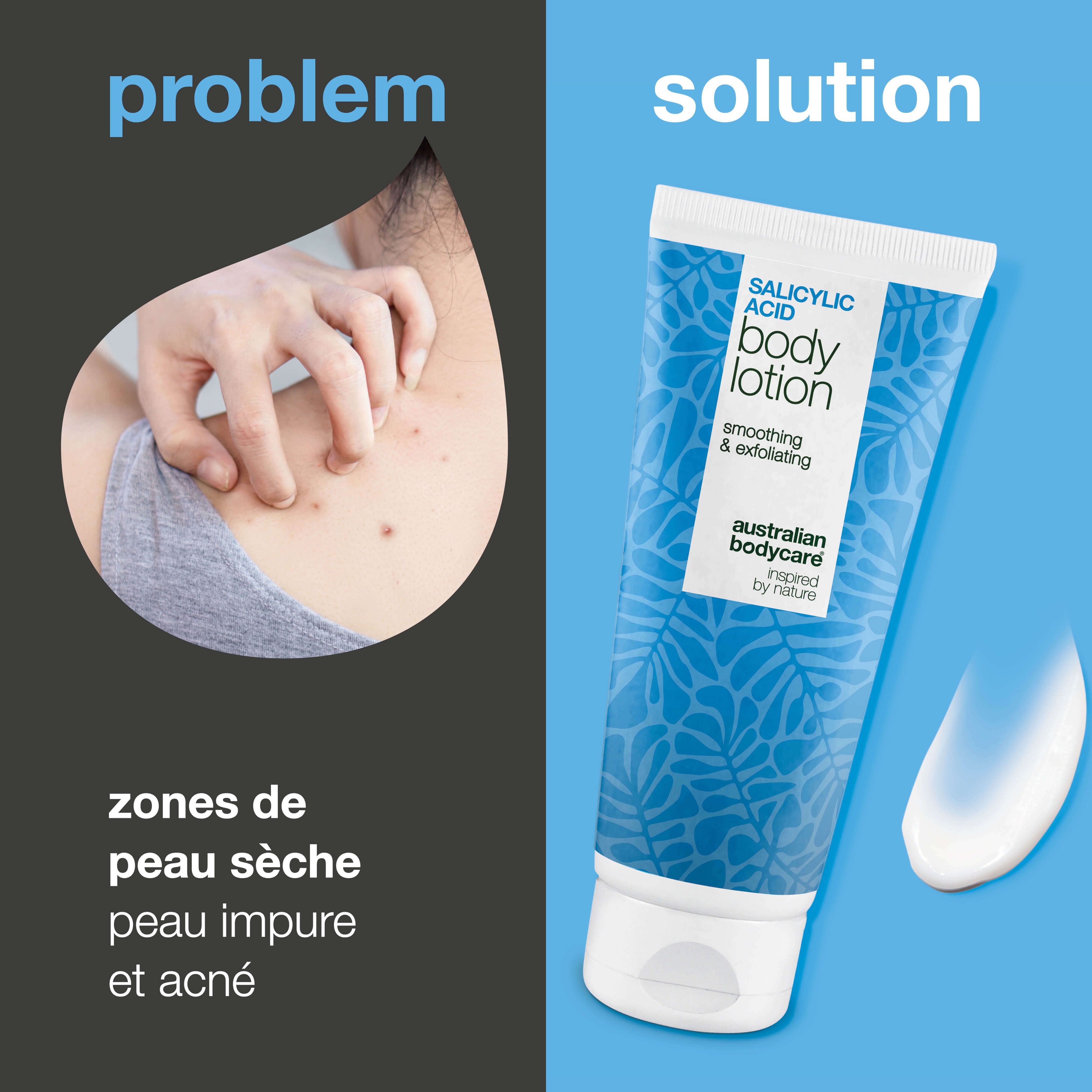 Comparaison : problème de peau et solution. À gauche : personne se gratte. À droite : tube de lotion à l'acide salicylique.