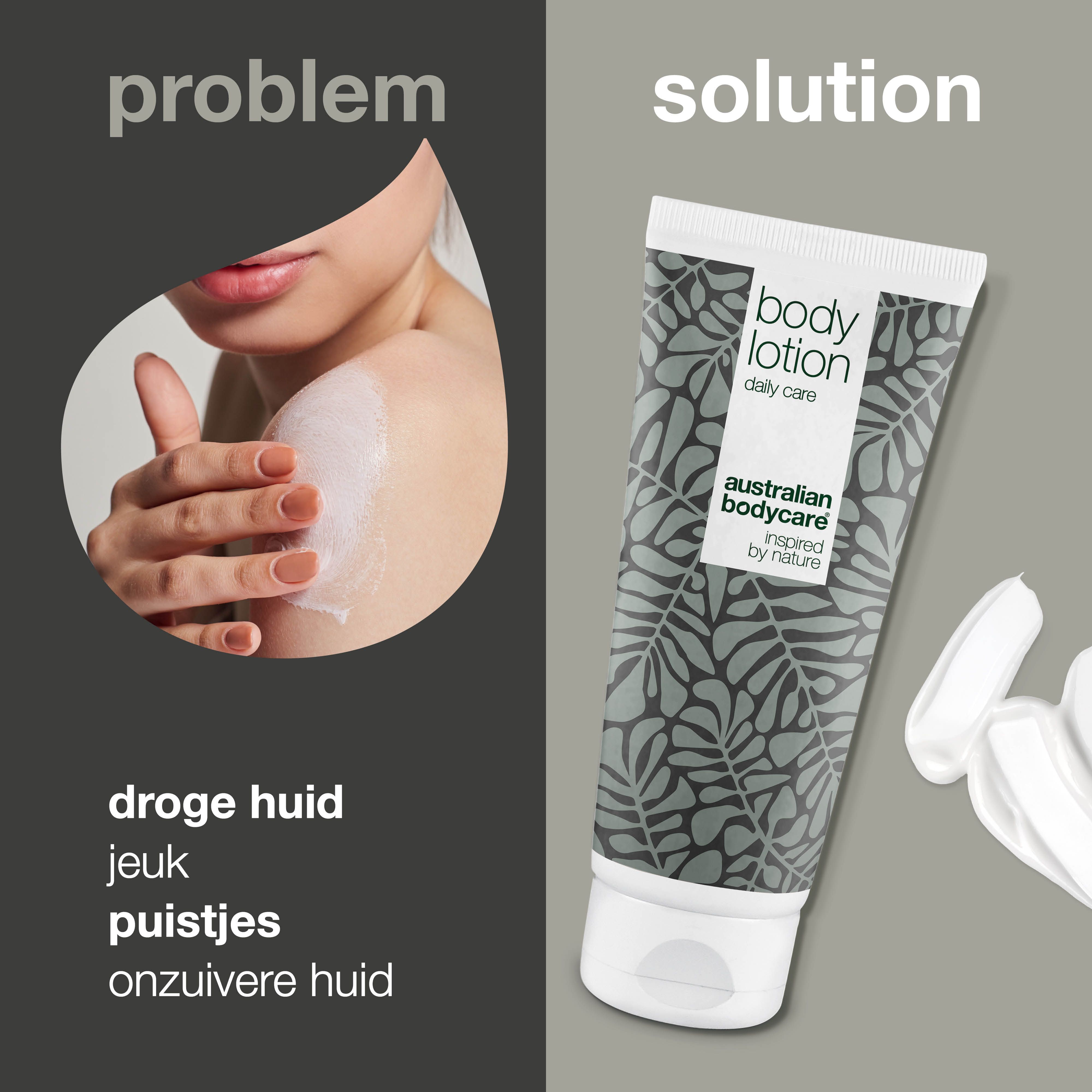 Vergelijking van huidproblemen en bodylotion. Tube met tekst "Body Lotion".