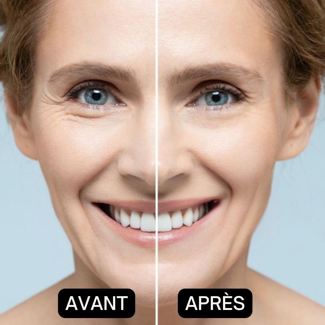 Image avant-après d'une femme. La moitié gauche du visage montre des rides, la droite une peau lisse.