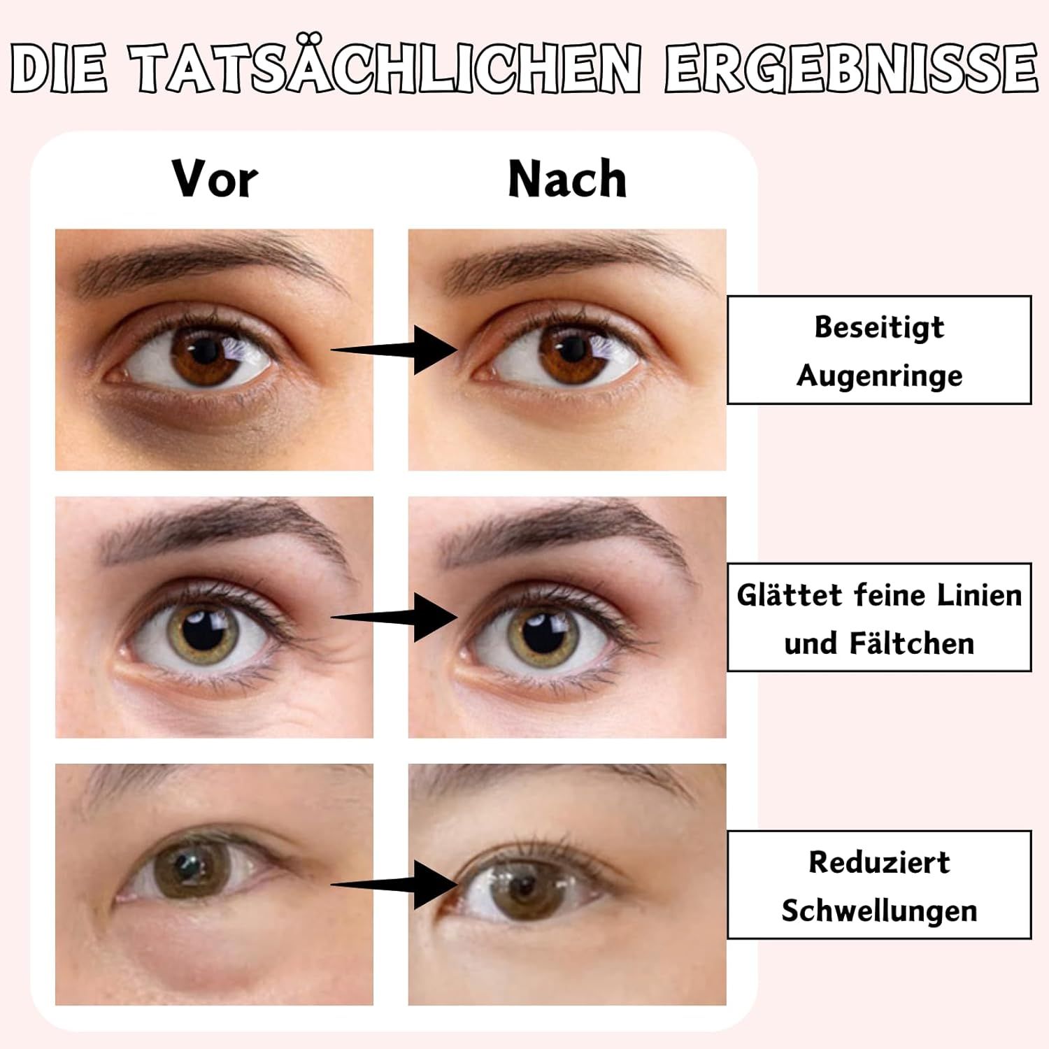 SUMMISHI Soin Coréen Ginseng + Rétinal Crème Contour des Yeux & Patchs Yeux