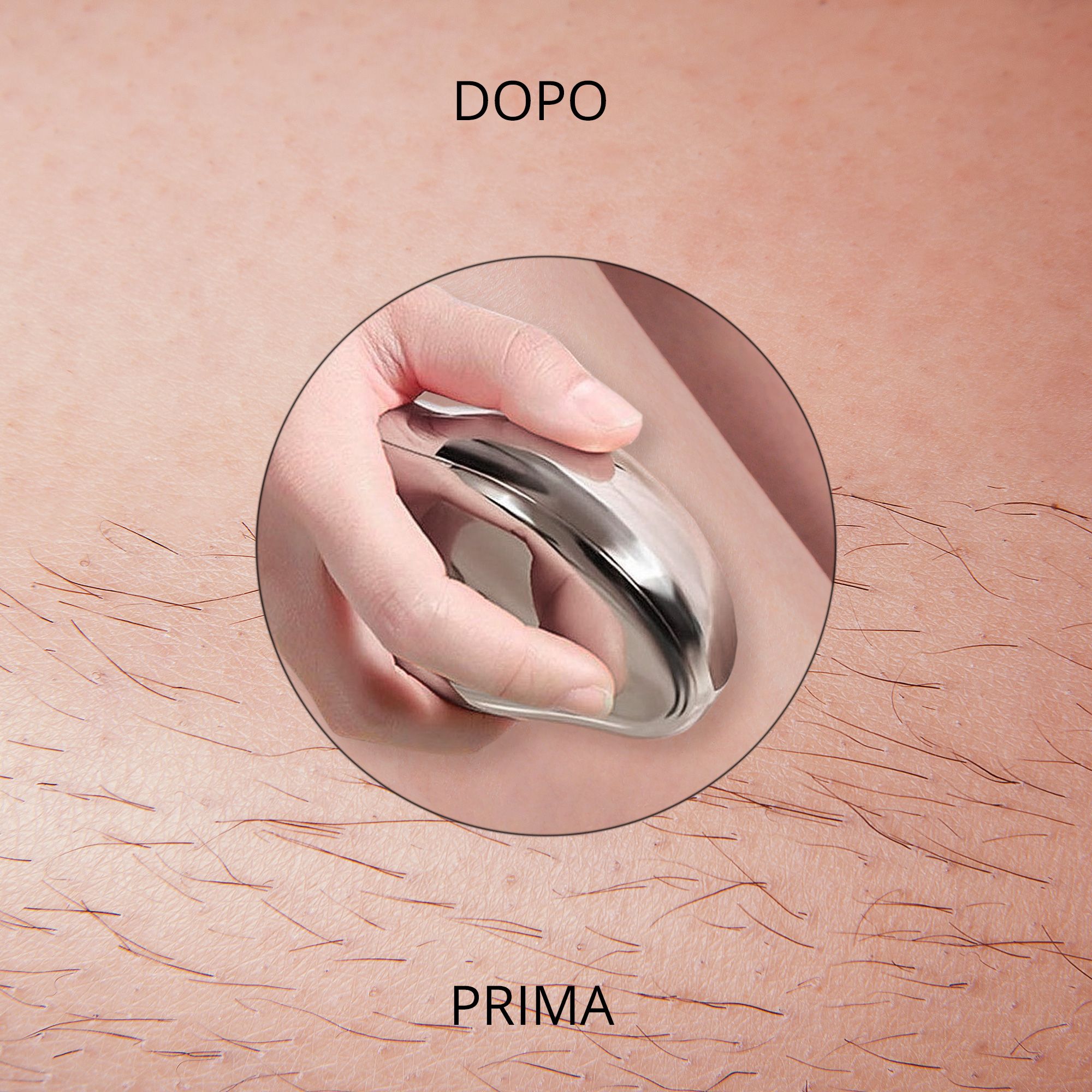 Gros plan d'un épilateur dans une main. L'épilateur est utilisé sur la peau. Inscription : PRIMA, DOPO.