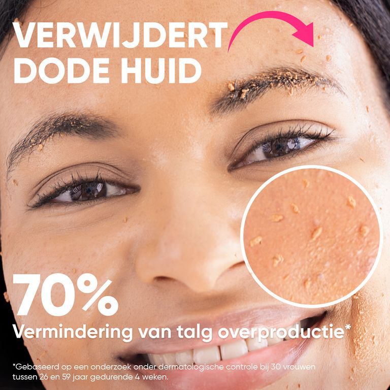 Close-up van een vrouw wiens huid dode huidcellen vertoont die worden verwijderd door de "Peels So Good" peeling van âme pure.