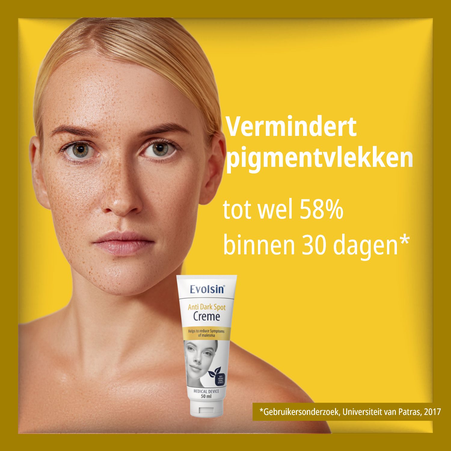 Vrouw met pigmentvlekken. Tekst: Vermindert pigmentvlekken tot 58% binnen 30 dagen.