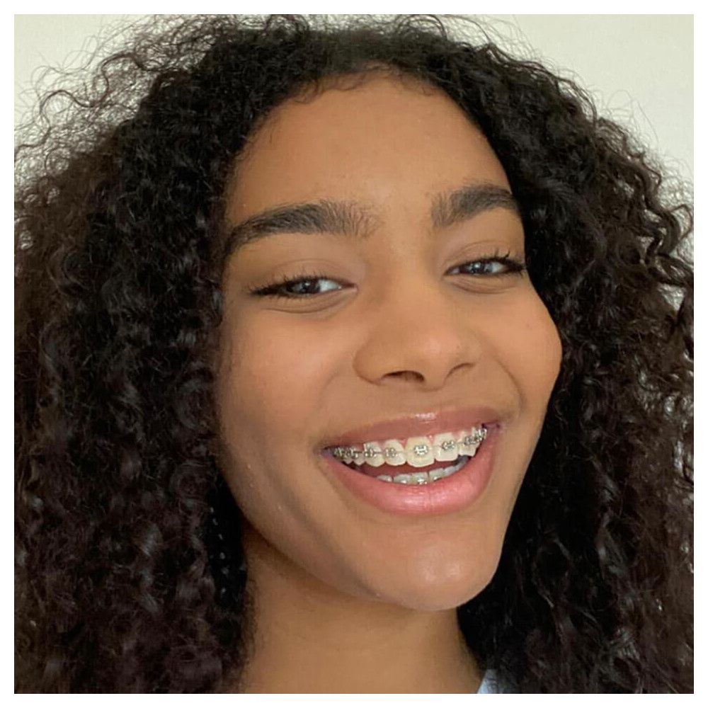 Portrait d'une personne souriante avec des boucles et un appareil dentaire.