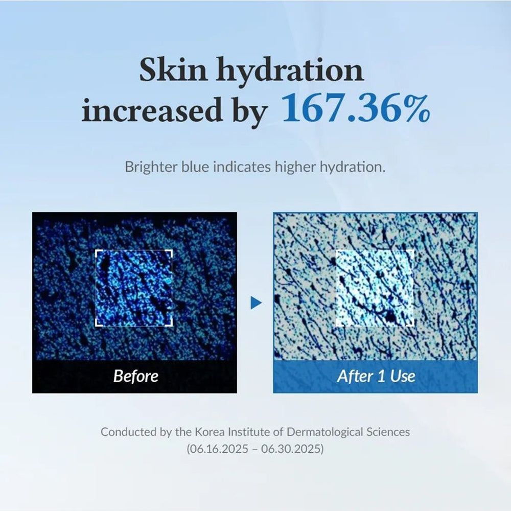 Graphique montrant l'hydratation de la peau avant et après utilisation, avec pourcentage.